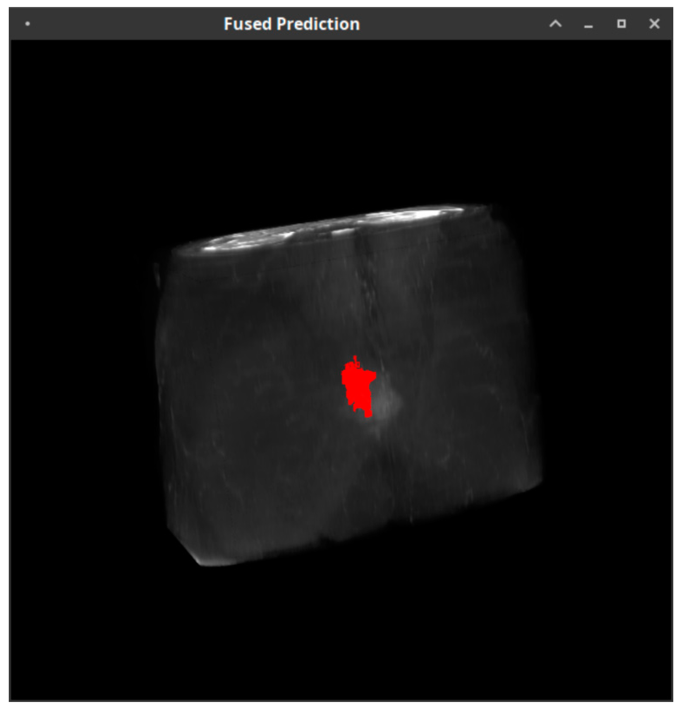 Cancers 15 01058 g003