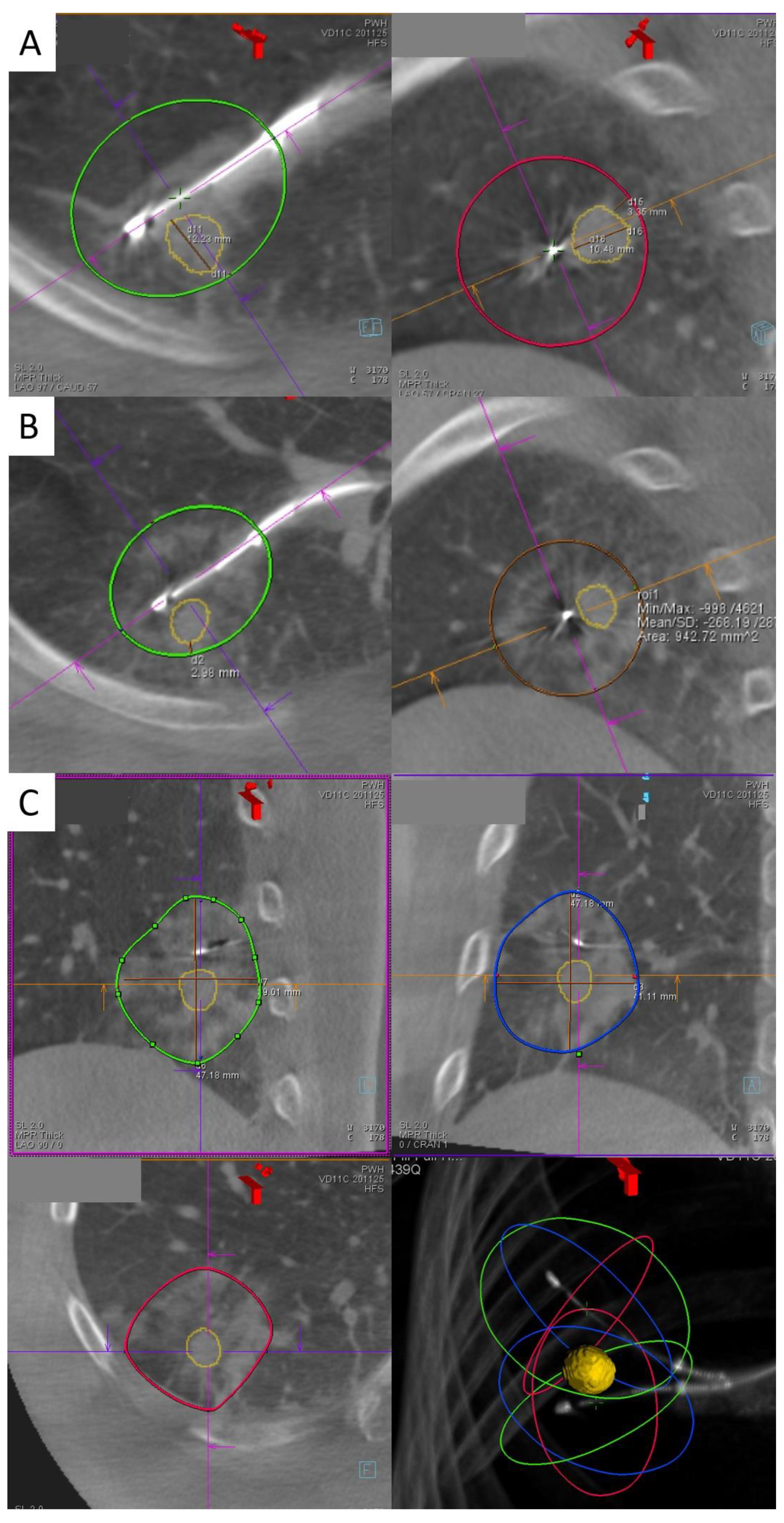 Cancers 15 01068 g001 550