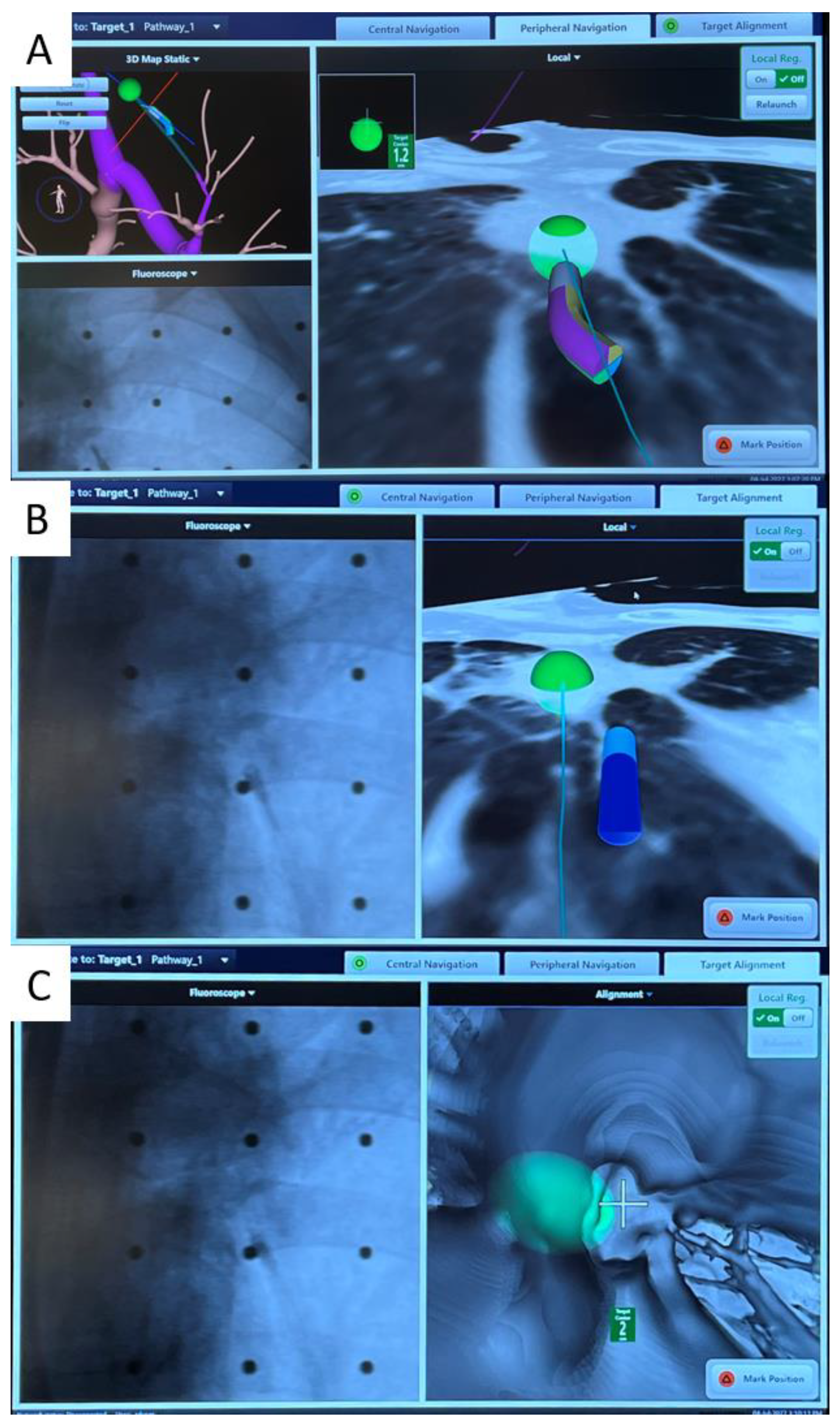 Cancers 15 01068 g002 550