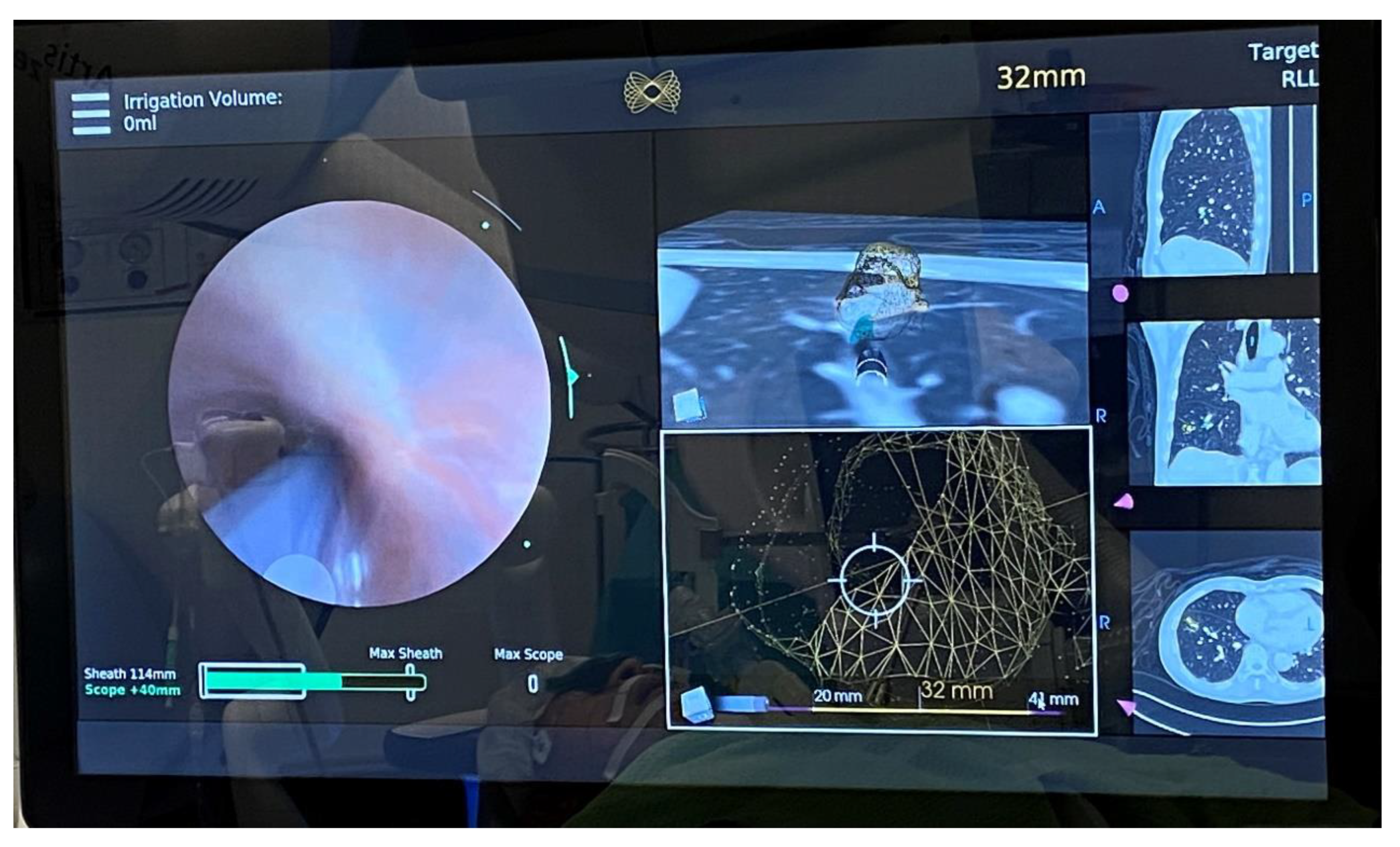 Cancers 15 01068 g005 550