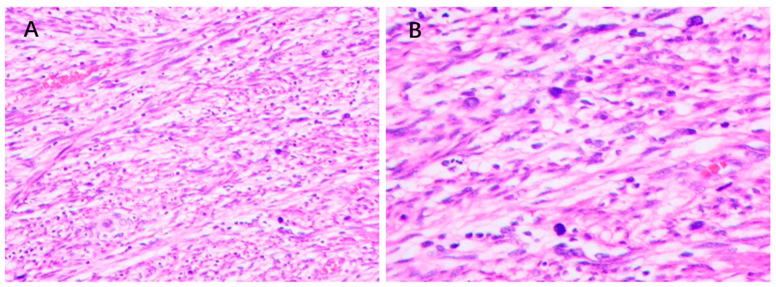 Cancers 15 01077 g005 Cancers 15 01077 g005