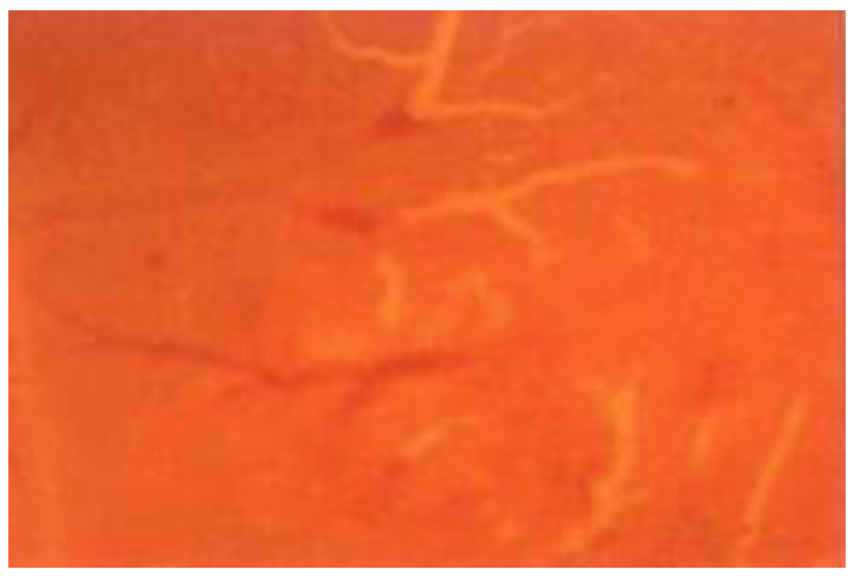 Cancers 15 01110 g002 Cancers 15 01110 g002