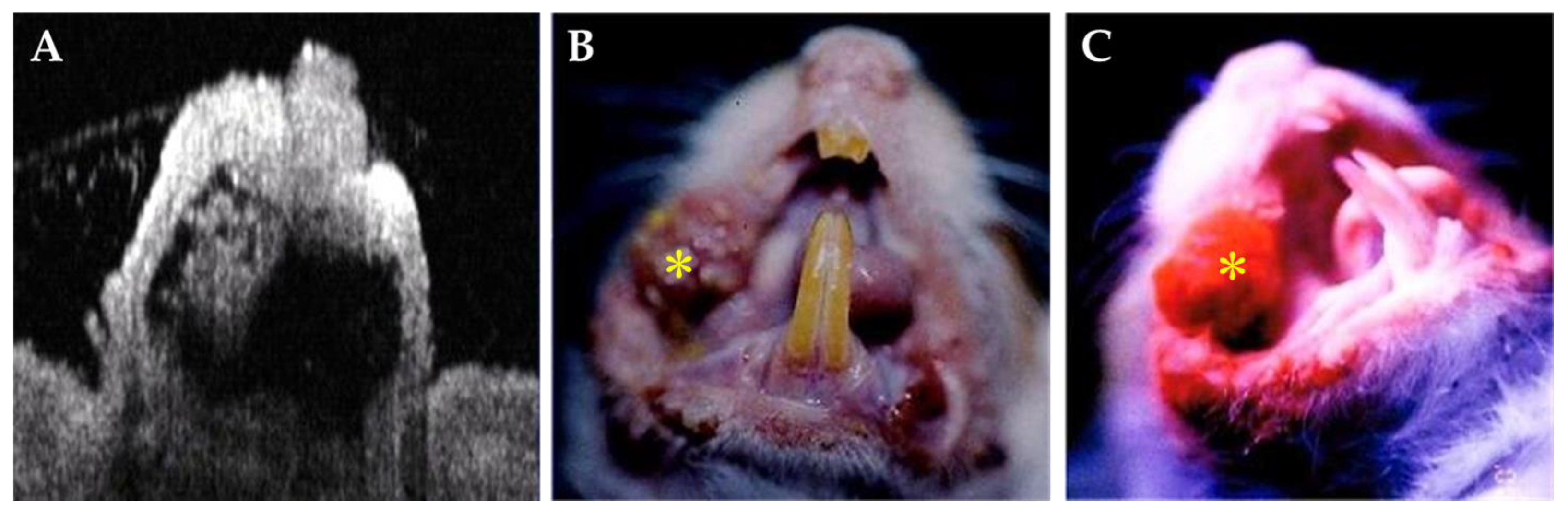 Cancers 15 01110 g003 Cancers 15 01110 g003