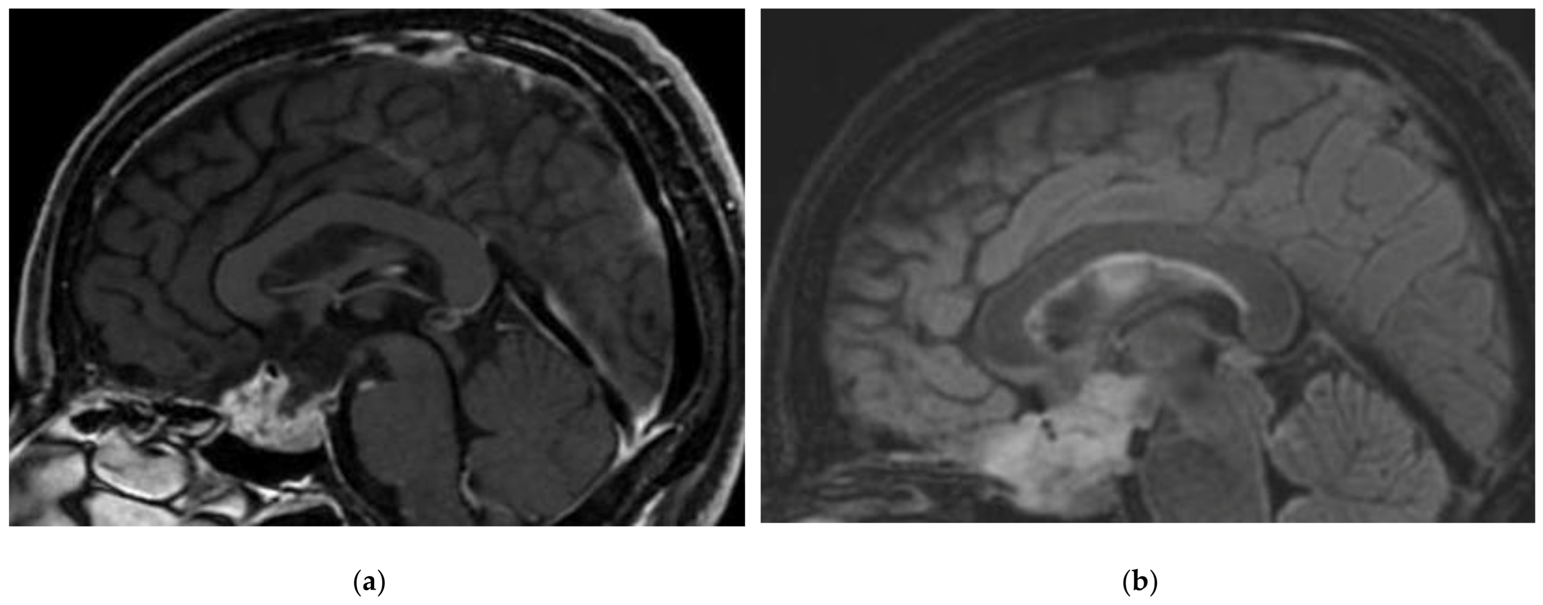 Cancers 15 01120 g002