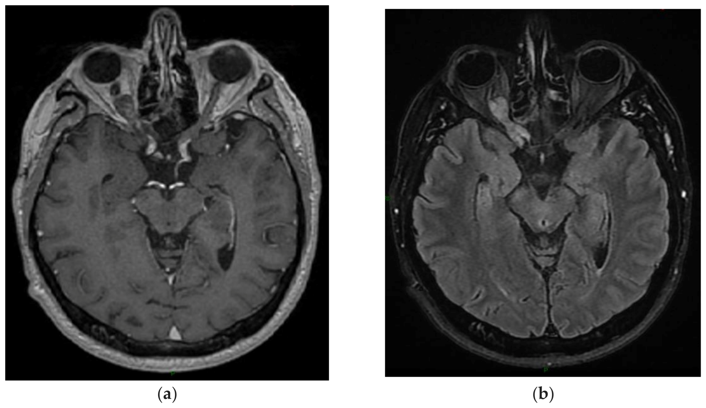 Cancers 15 01120 g005