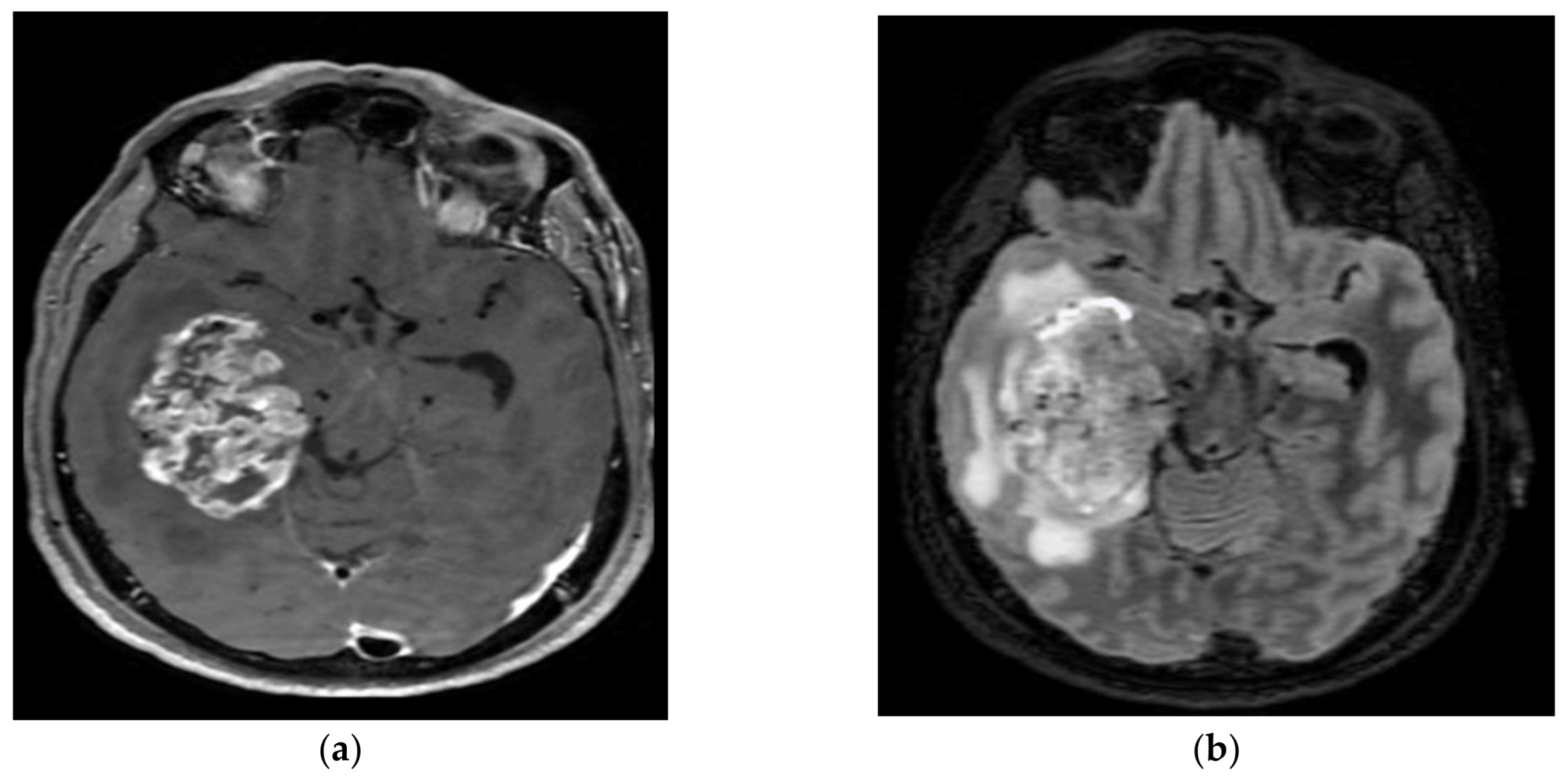 Cancers 15 01120 g007