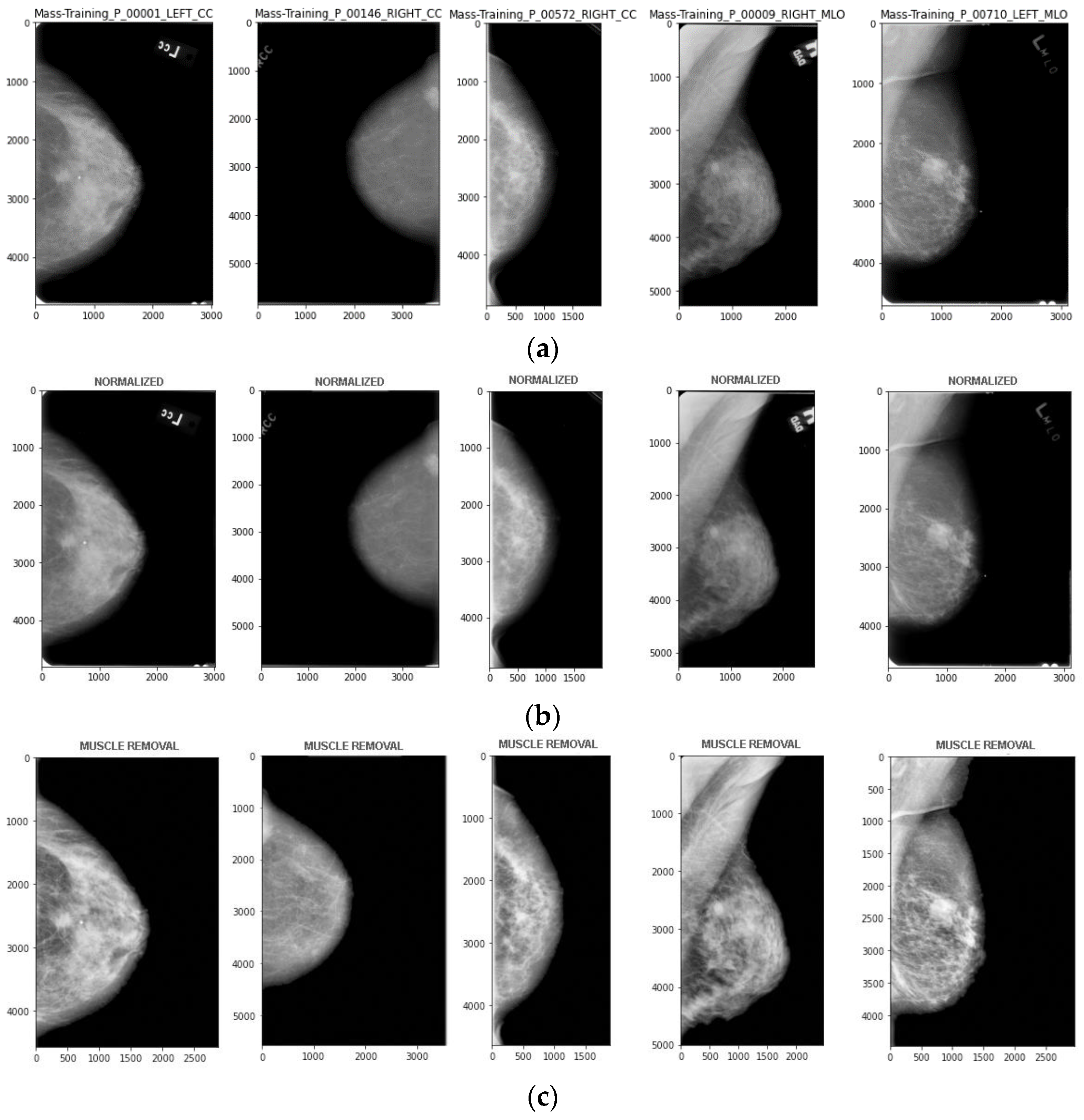 Cancers 15 01131 g003