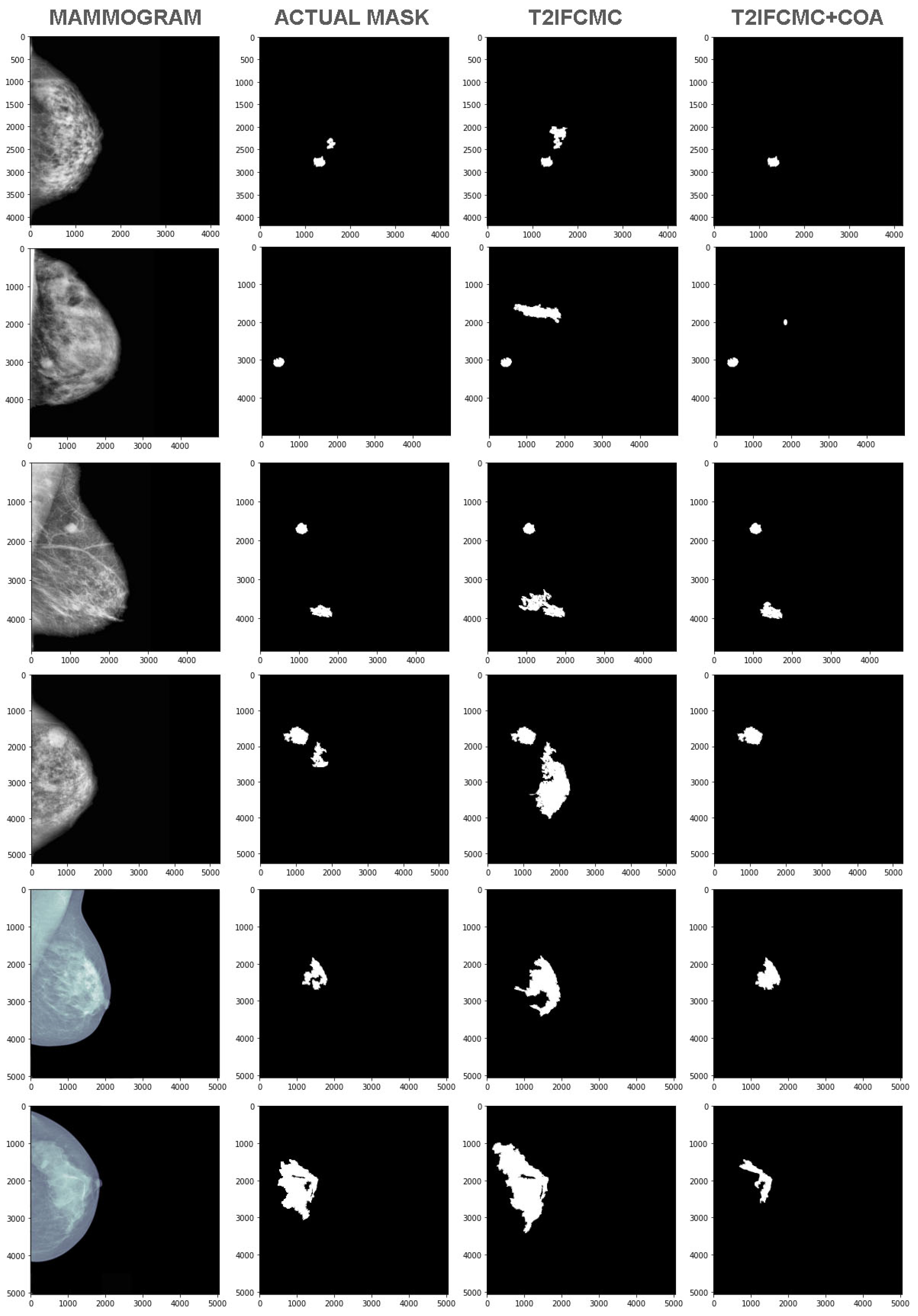 Cancers 15 01131 g005