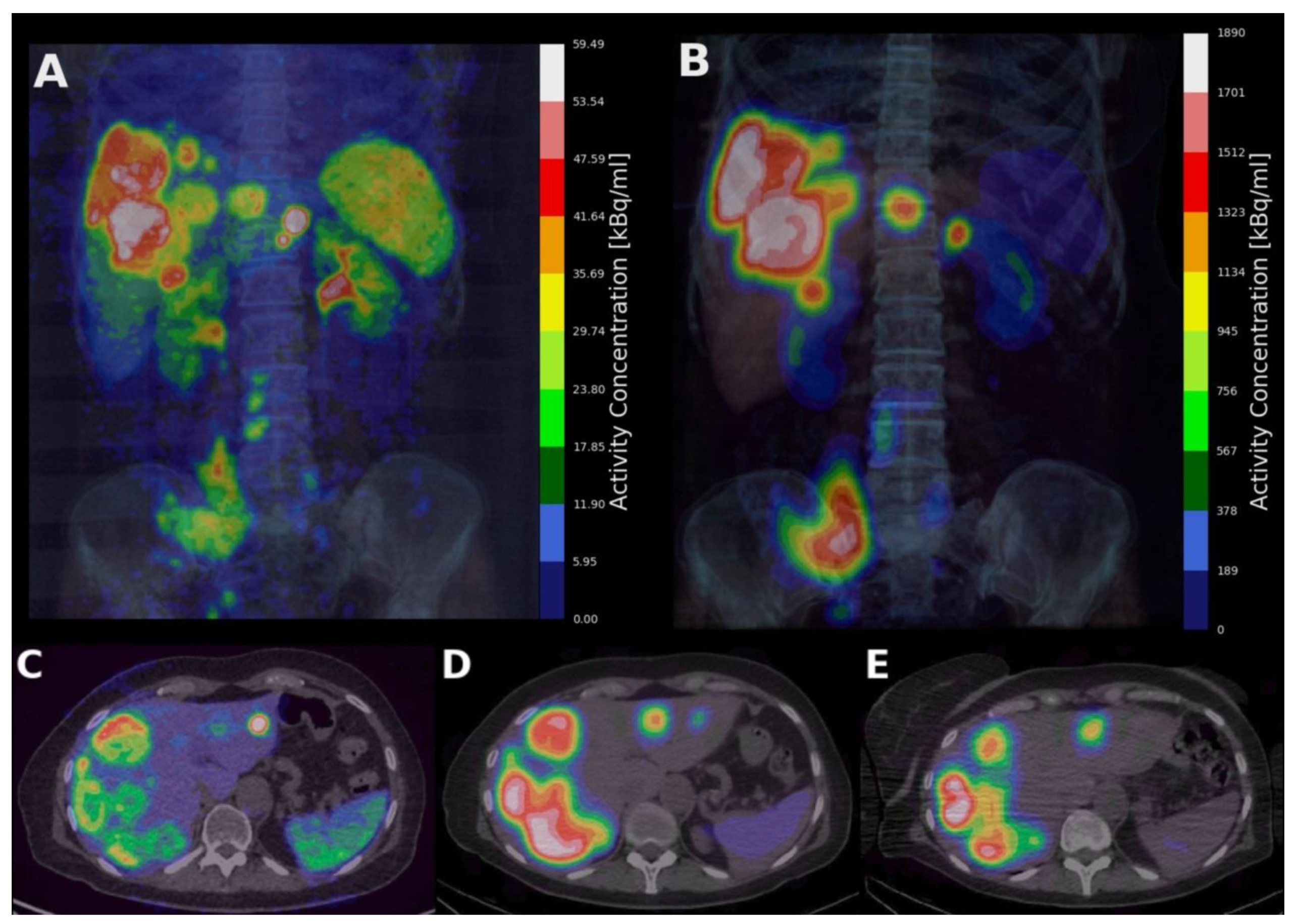 Cancers 15 01134 g001 Cancers 15 01134 g001