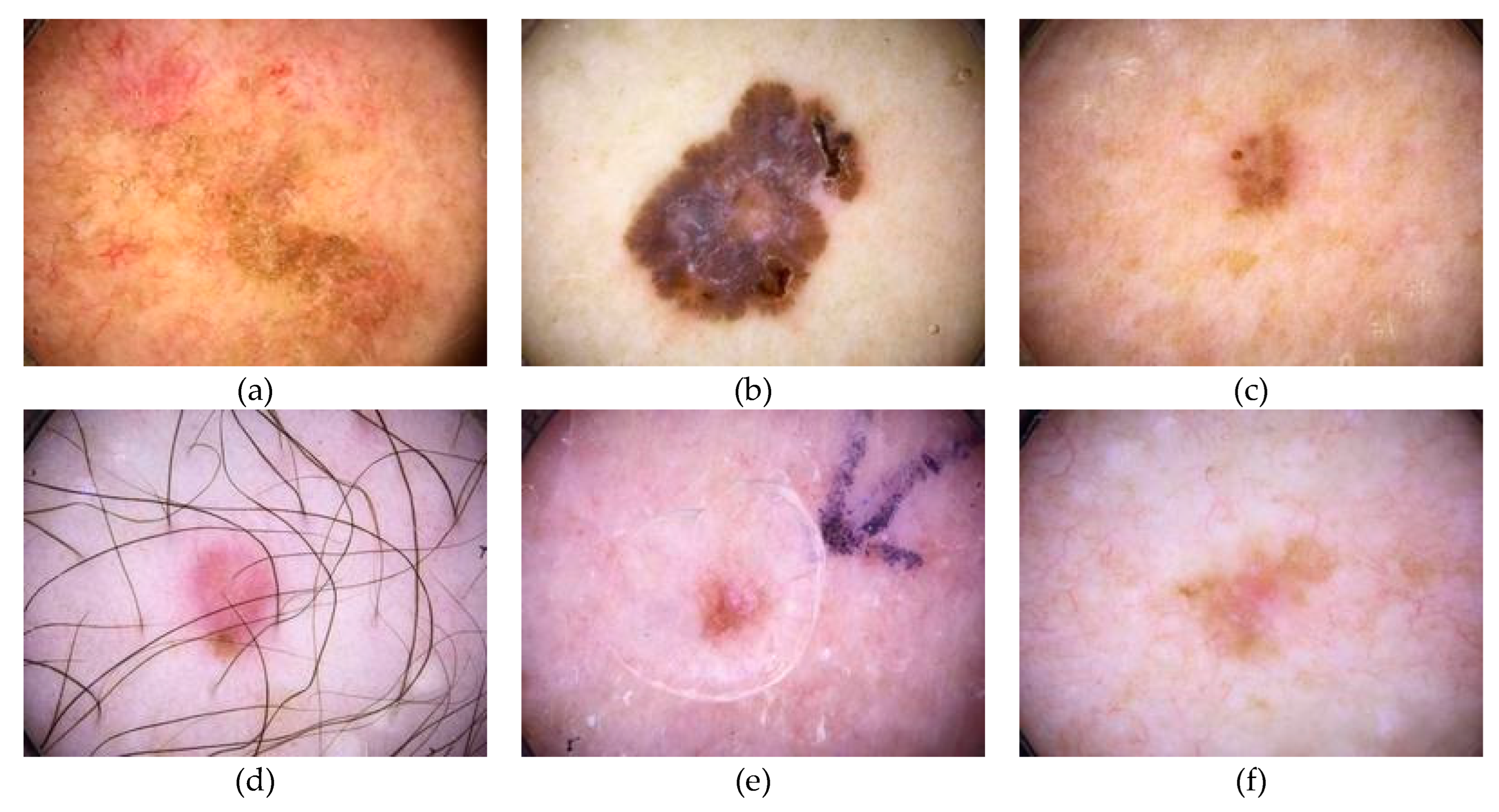 Cancers Free FullText AIPowered Diagnosis of Skin Cancer A