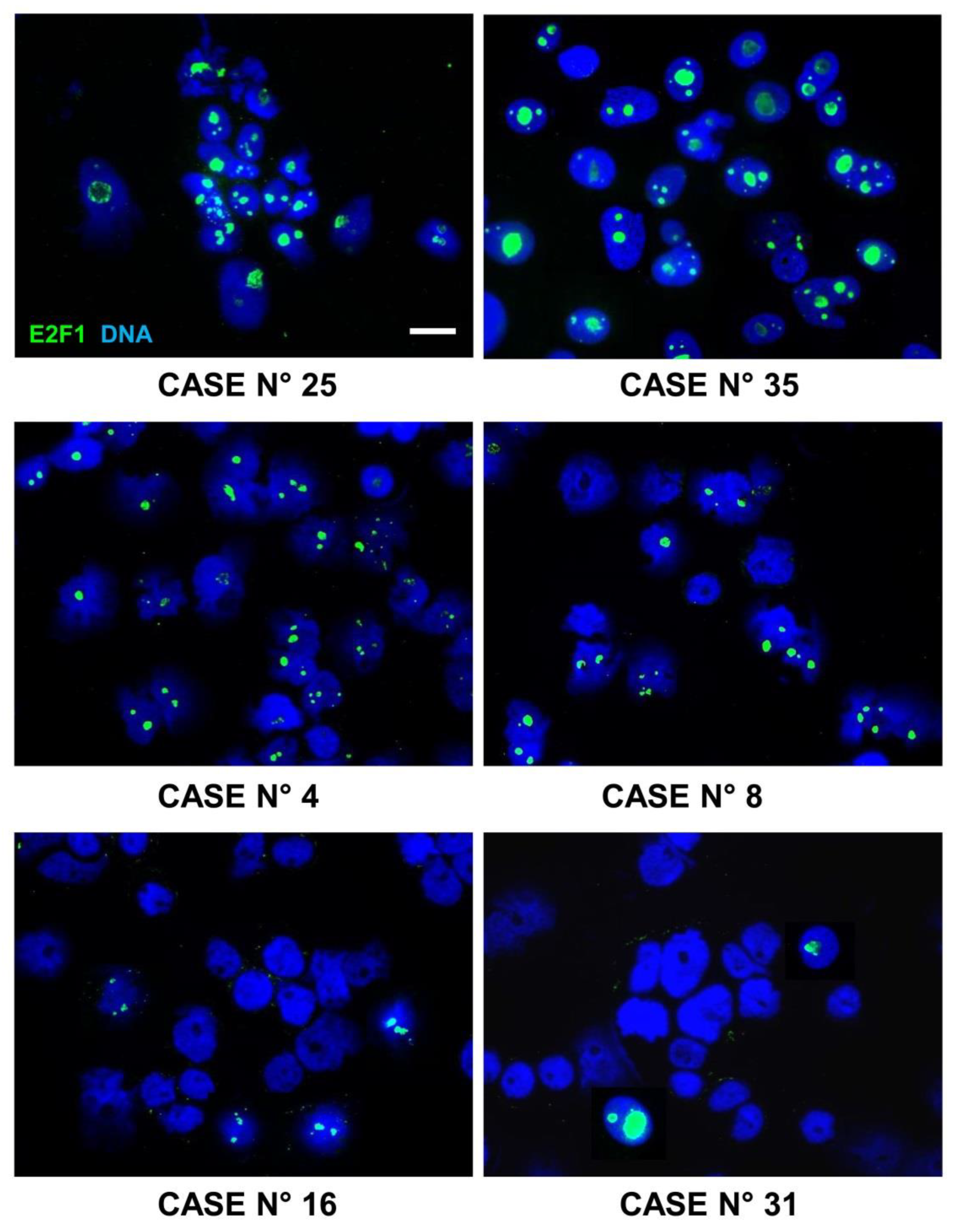 Cancers 15 01188 g009