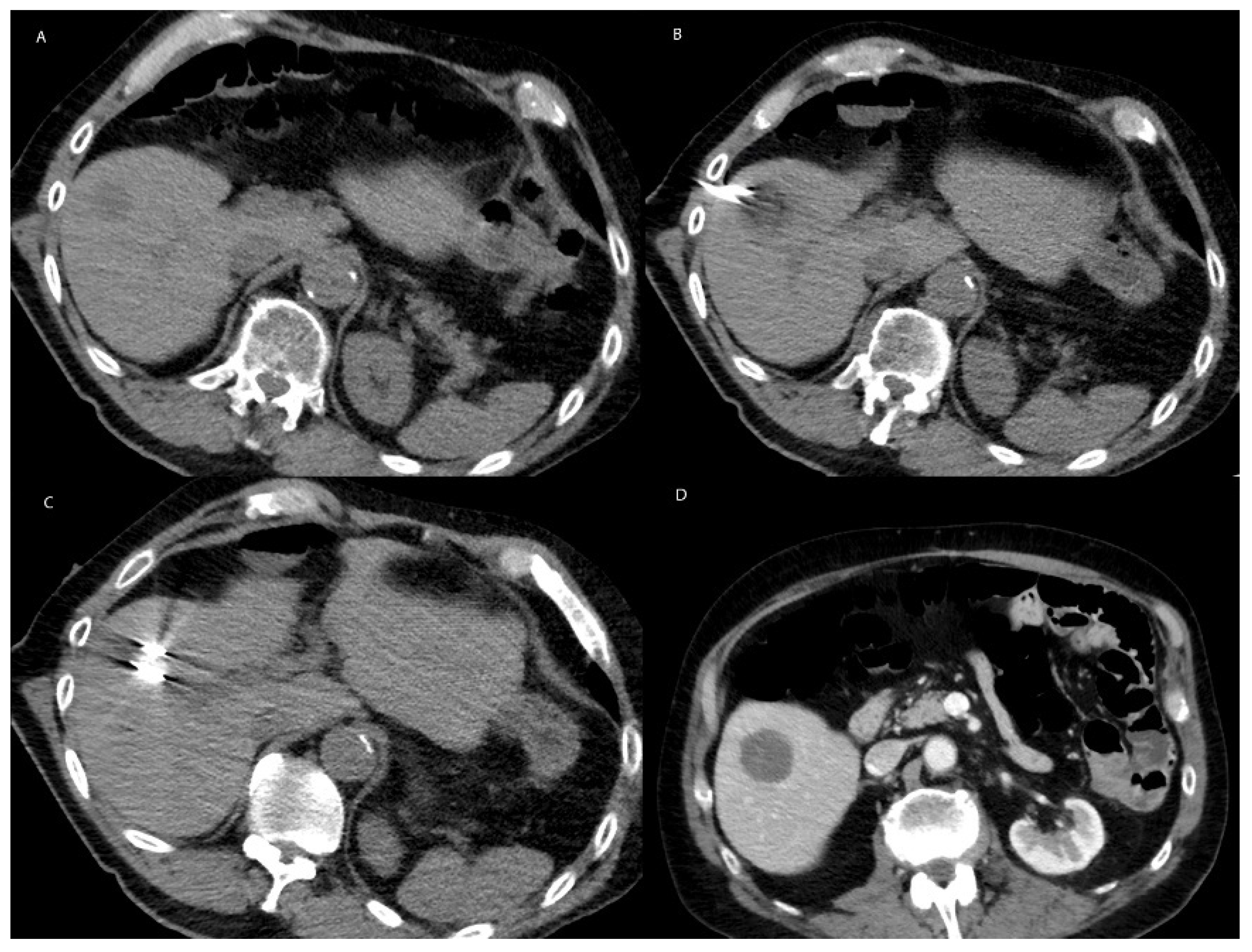 Cancers 15 01200 g002