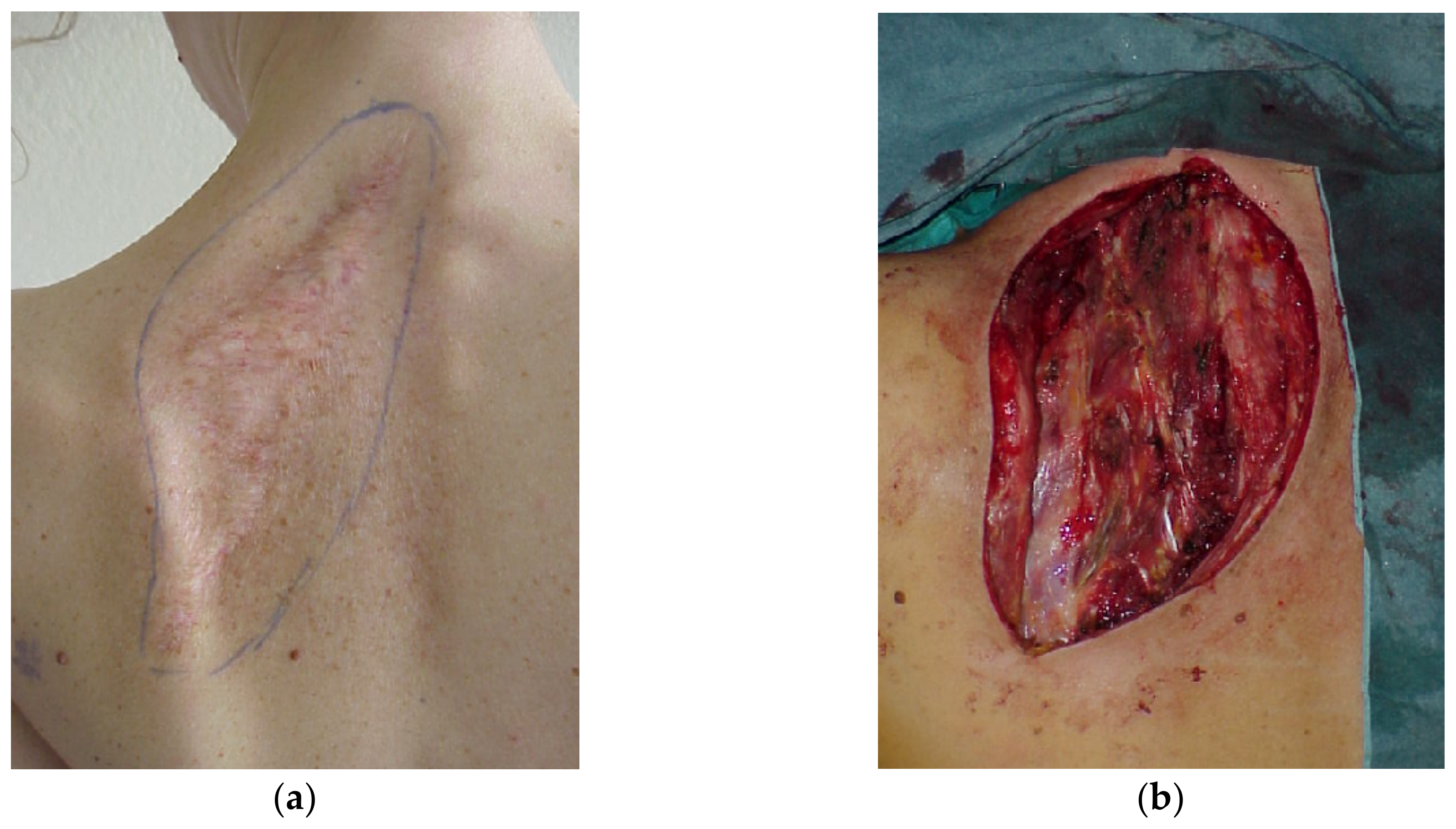 Cancers 15 01214 g002a Cancers 15 01214 g002a