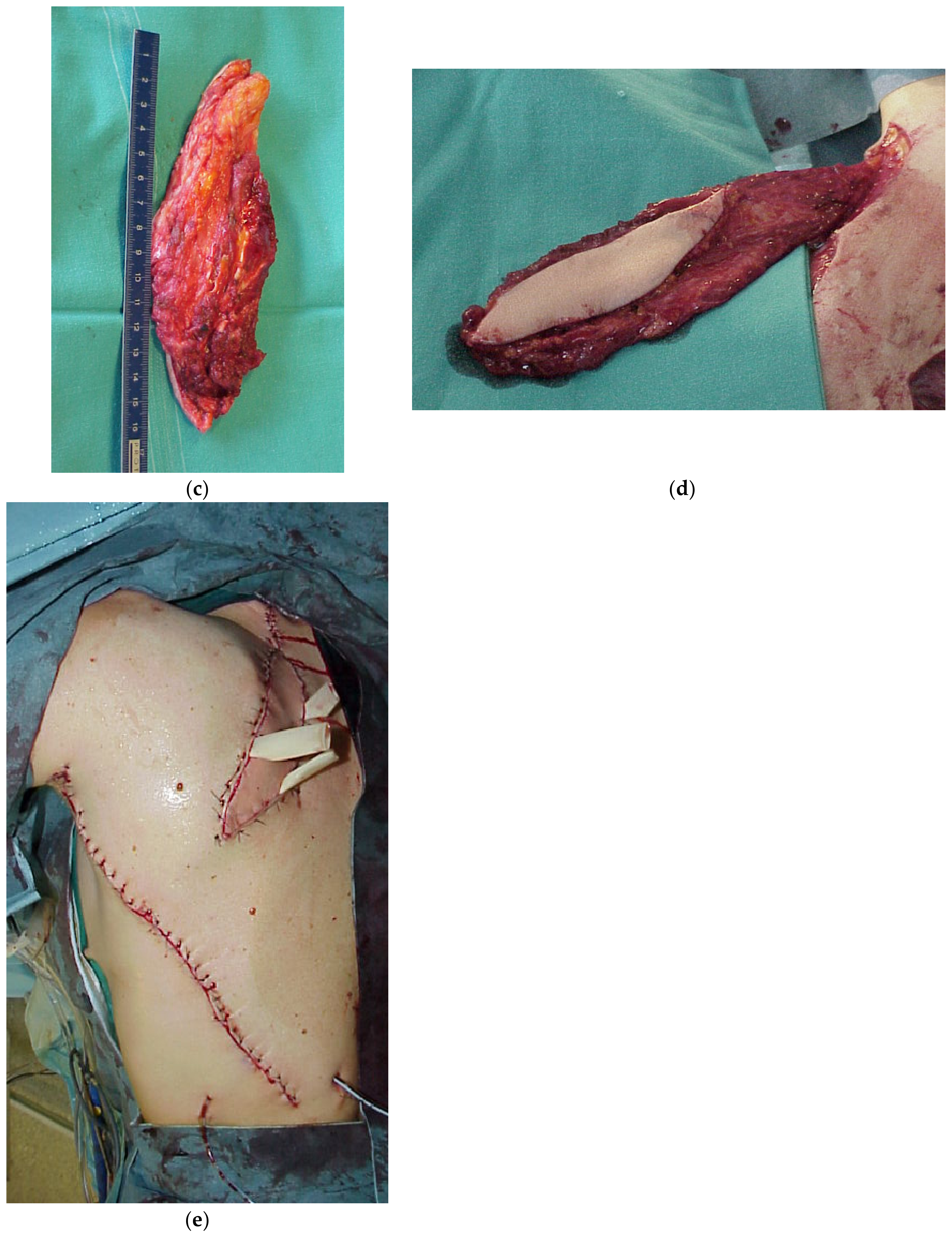 Cancers 15 01214 g002b Cancers 15 01214 g002b