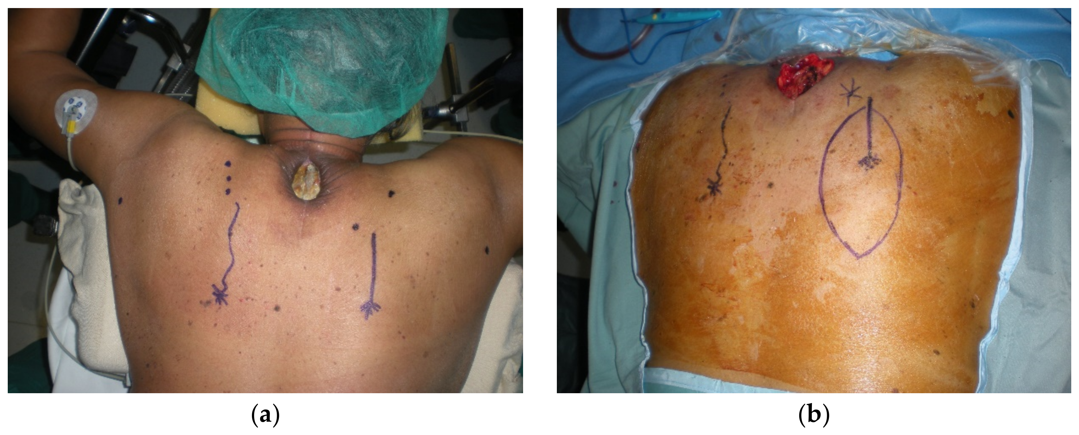 Cancers 15 01214 g005a Cancers 15 01214 g005a