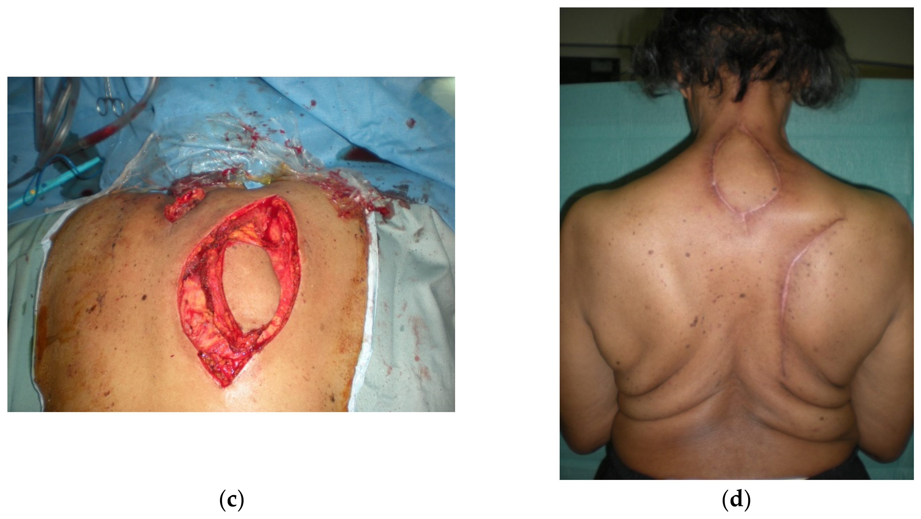 Cancers 15 01214 g005b Cancers 15 01214 g005b