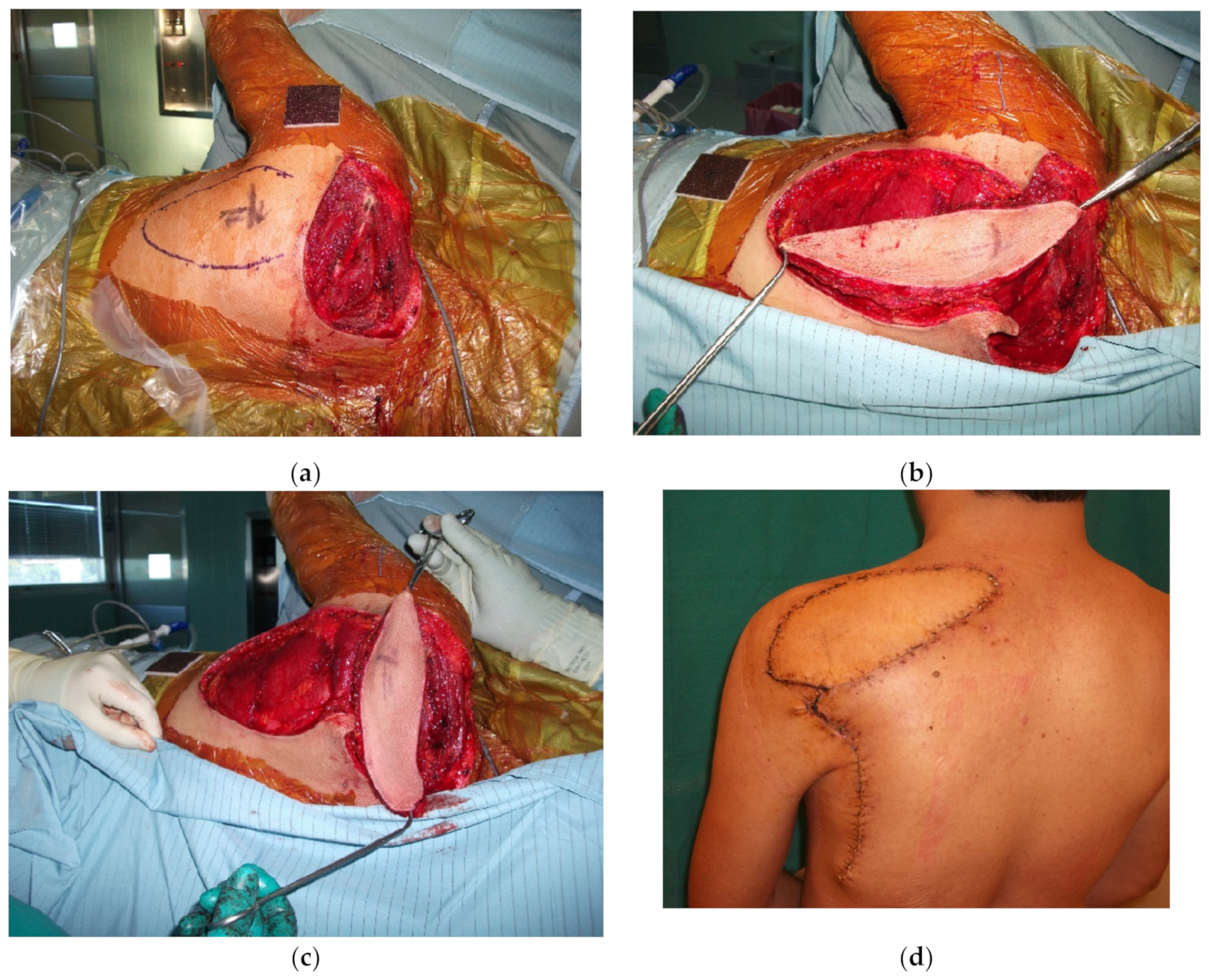 Cancers 15 01214 g006 Cancers 15 01214 g006