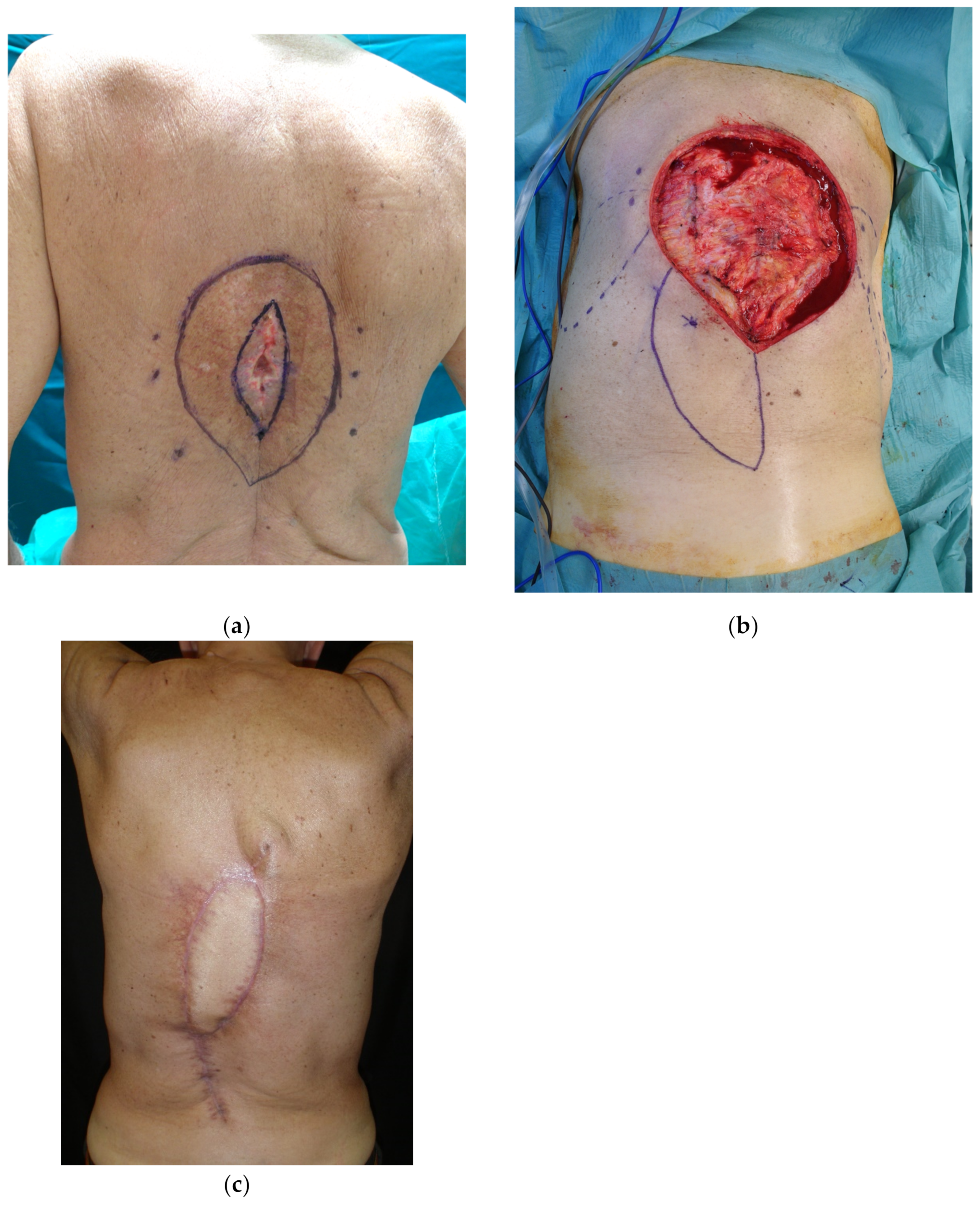 Cancers 15 01214 g007 Cancers 15 01214 g007