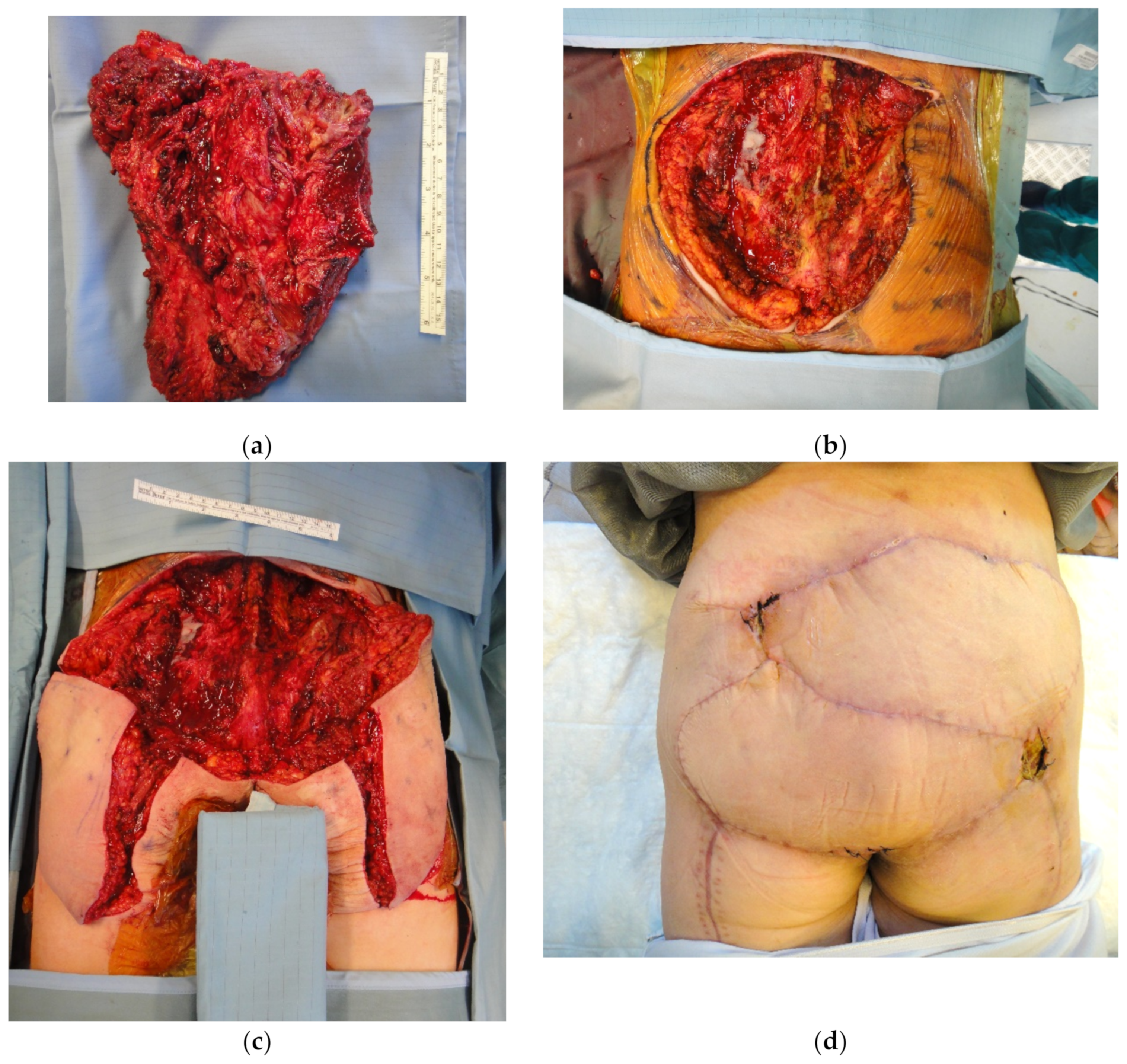 Cancers 15 01214 g008 Cancers 15 01214 g008