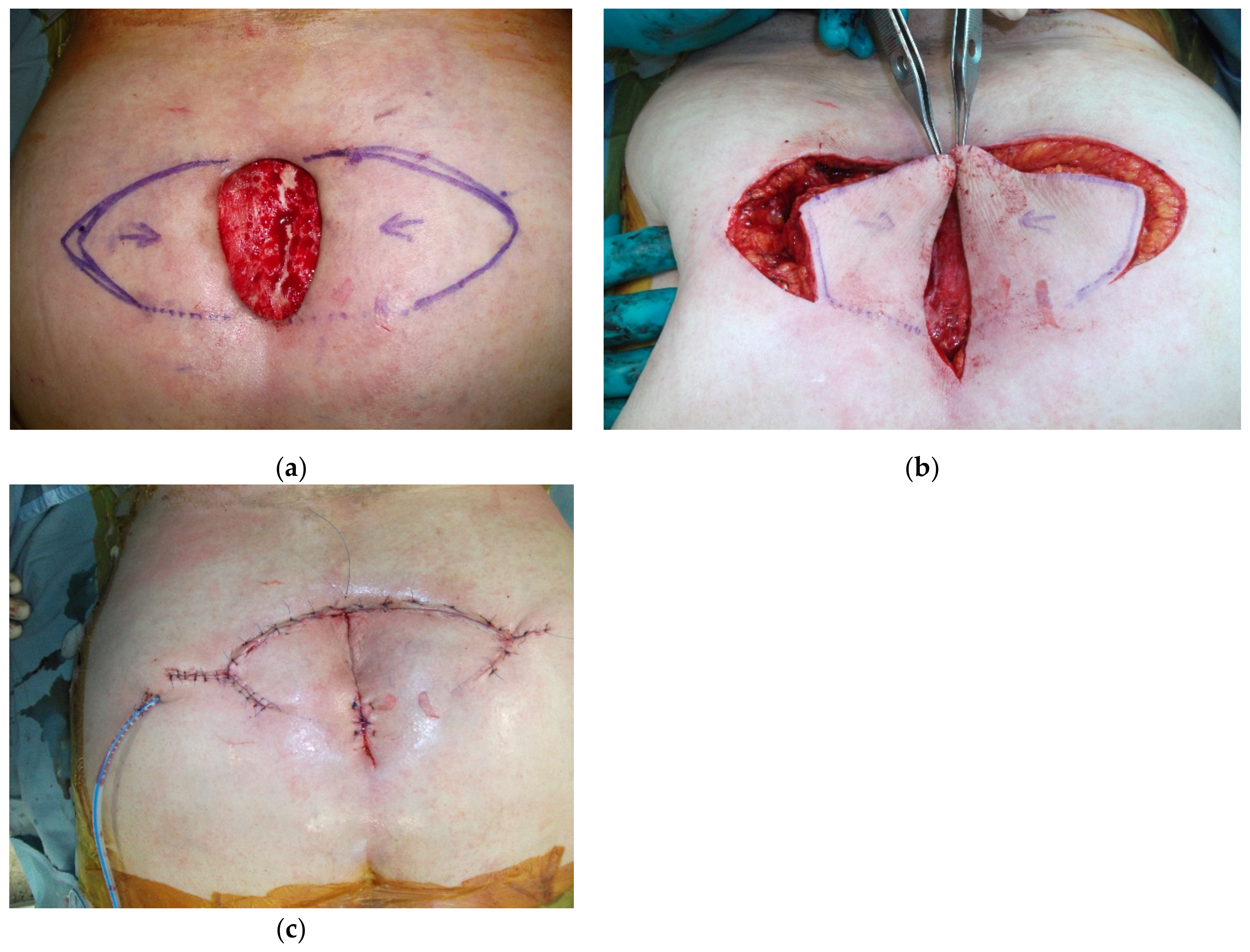 Cancers 15 01214 g009 Cancers 15 01214 g009