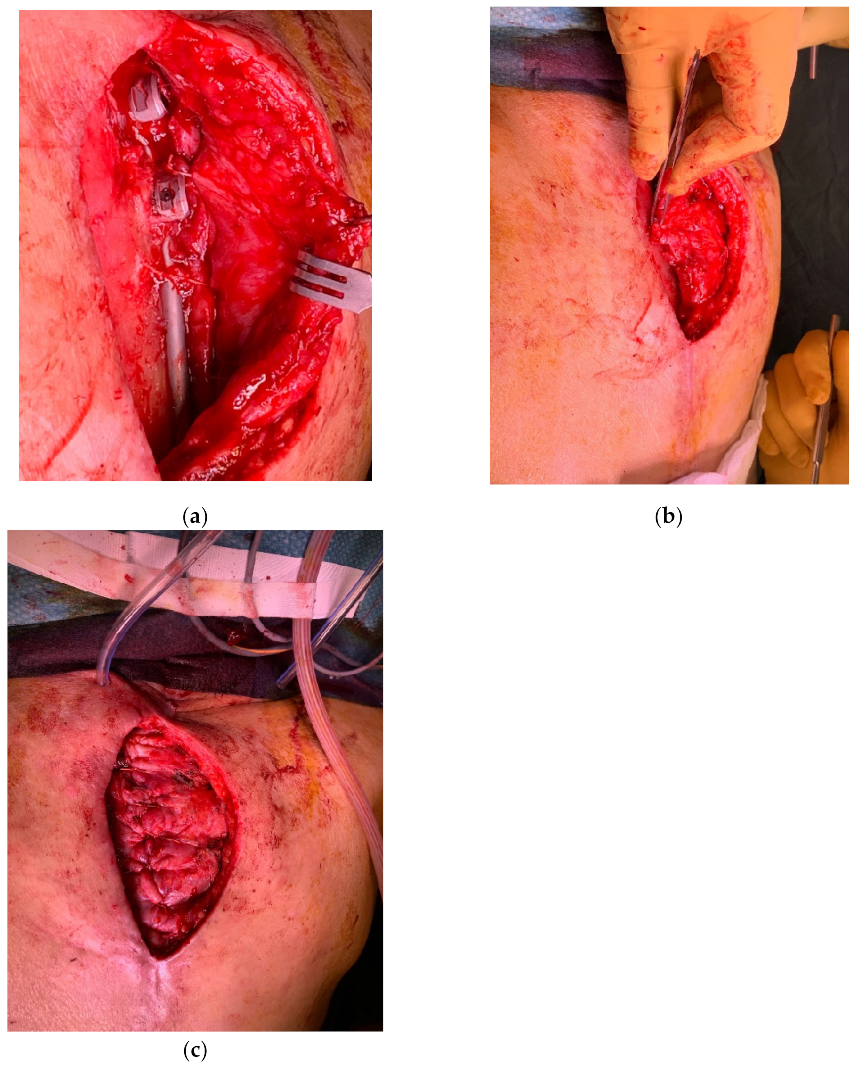 Cancers 15 01214 g010 Cancers 15 01214 g010