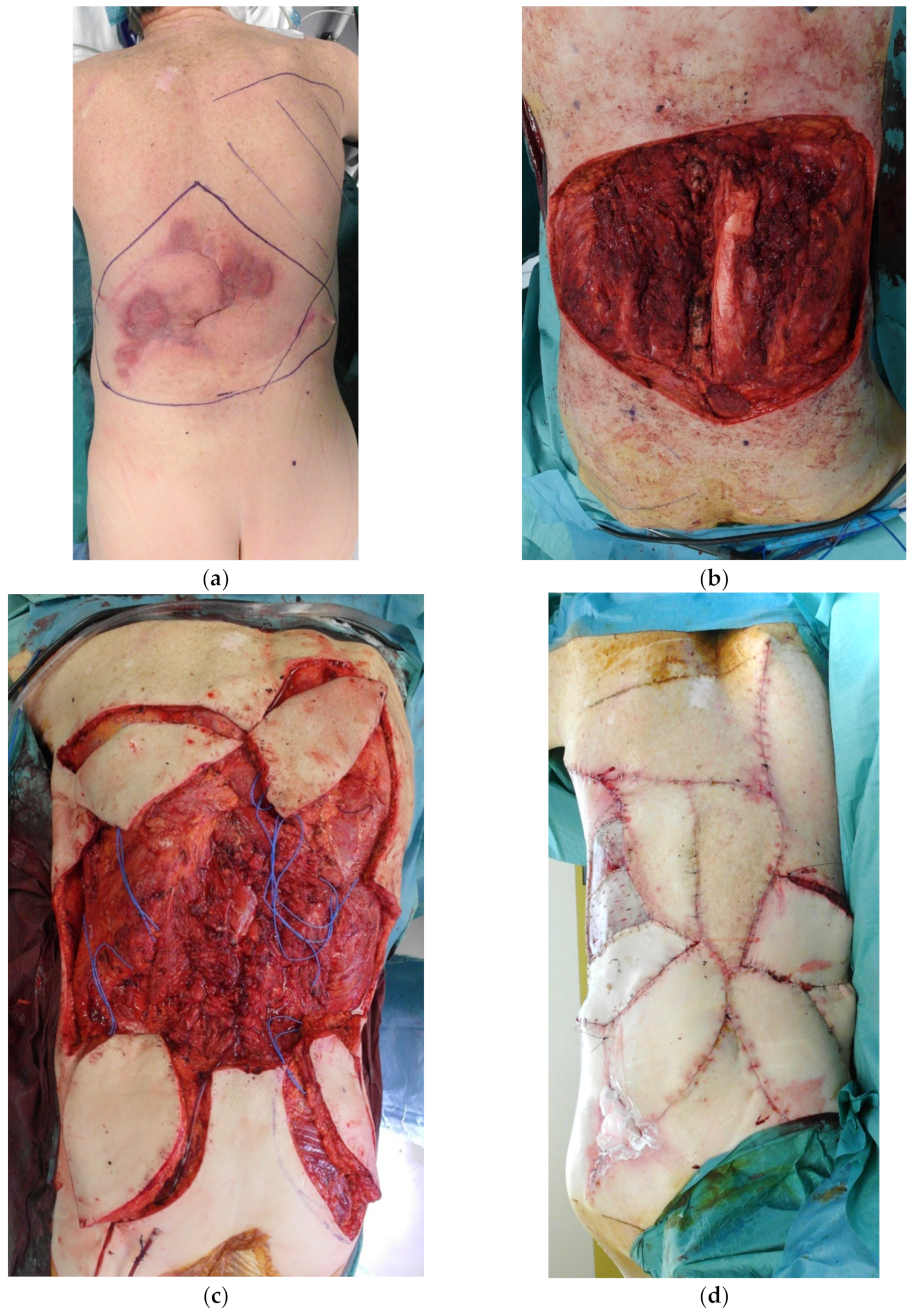 Cancers 15 01214 g011a Cancers 15 01214 g011a