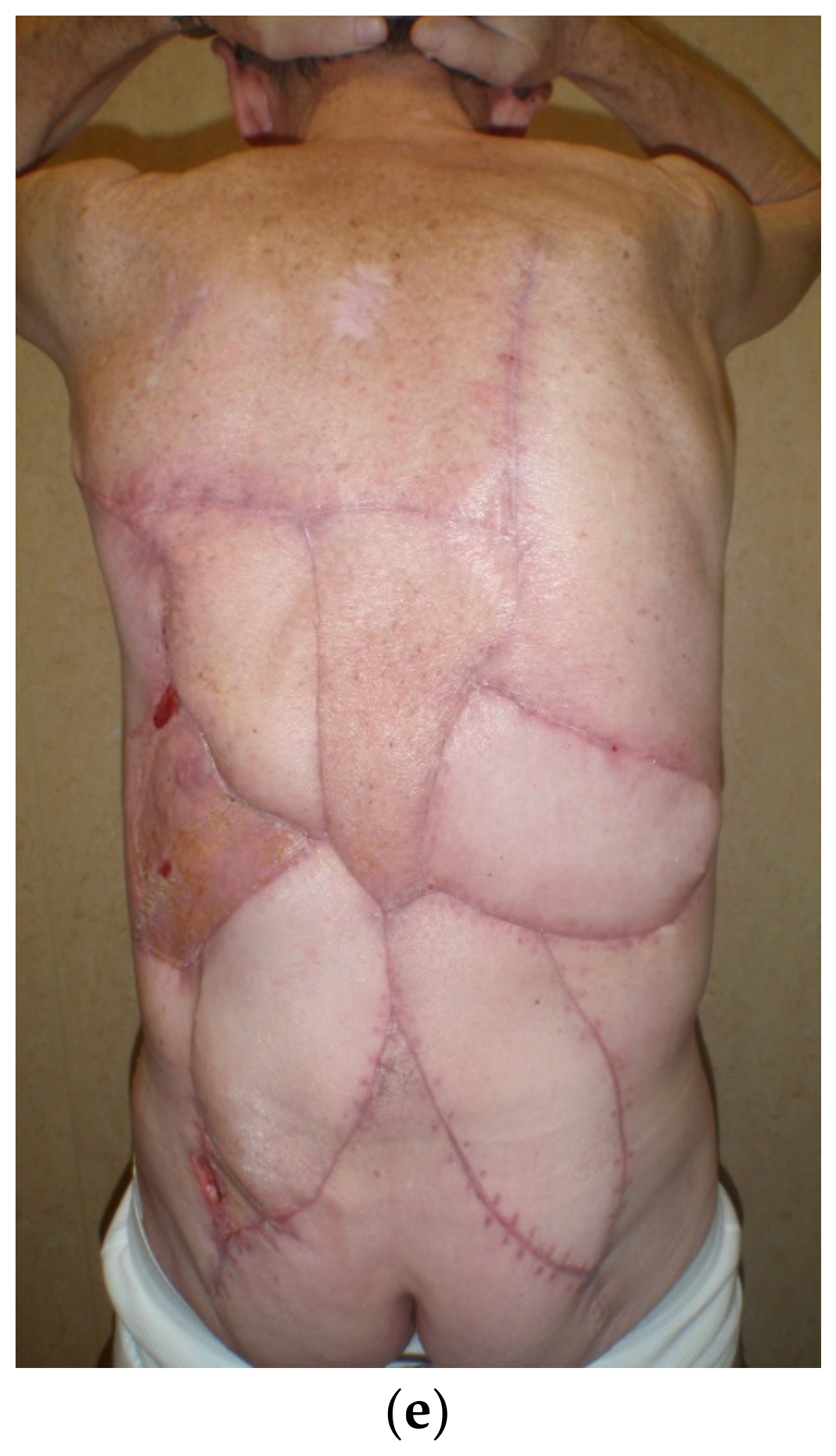 Cancers 15 01214 g011b Cancers 15 01214 g011b