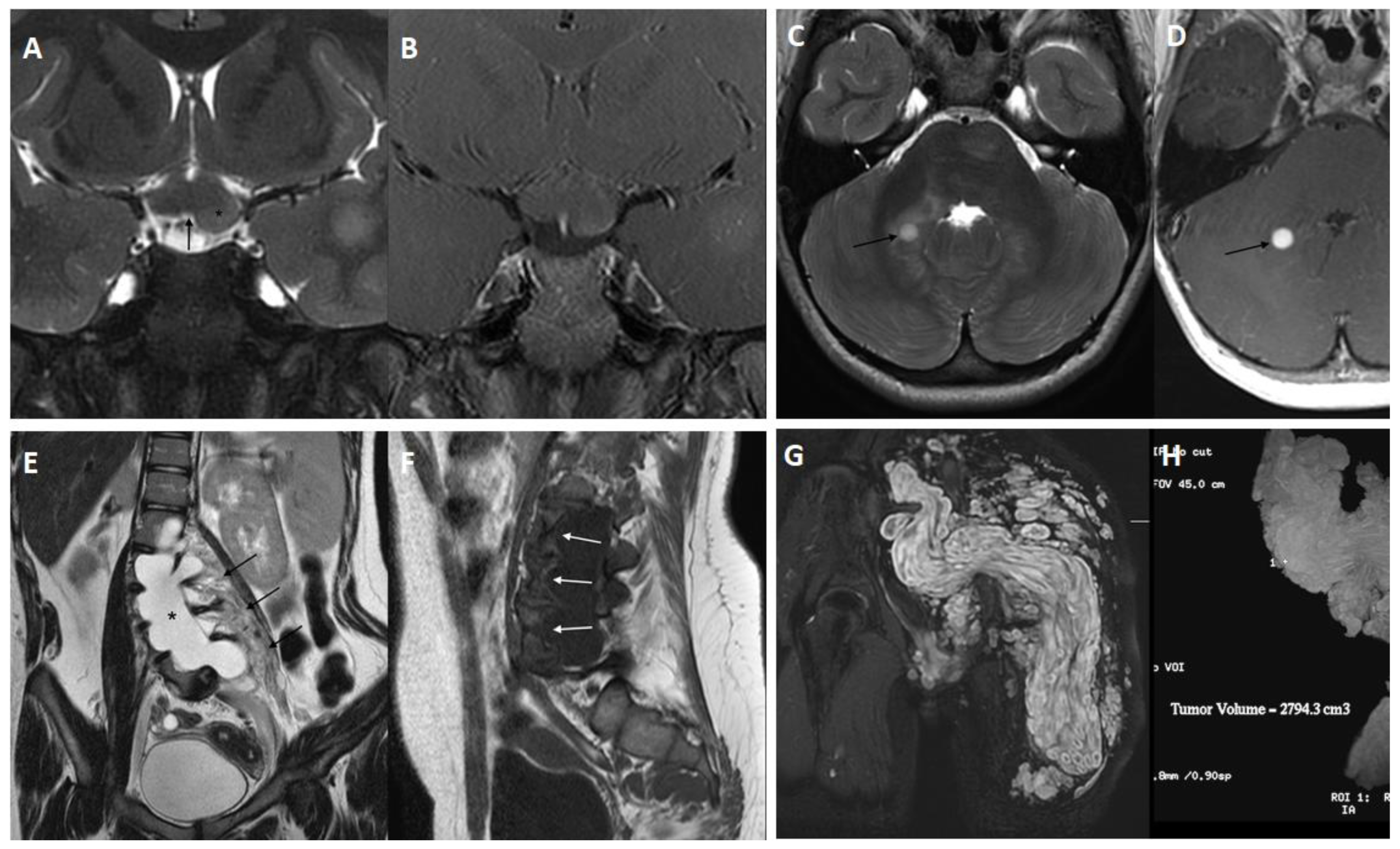 Cancers 15 01217 g003 Cancers 15 01217 g003