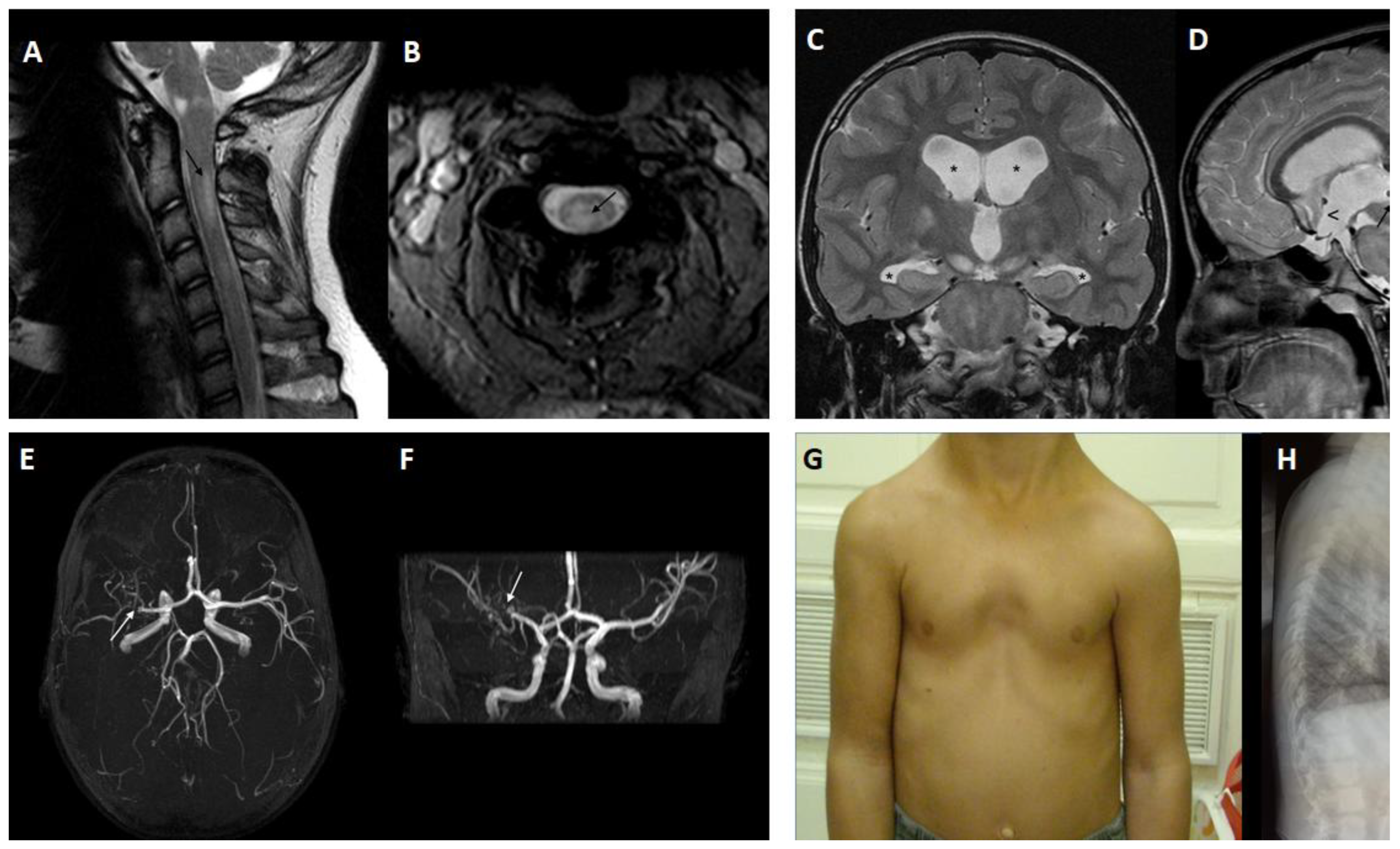 Cancers 15 01217 g004 Cancers 15 01217 g004