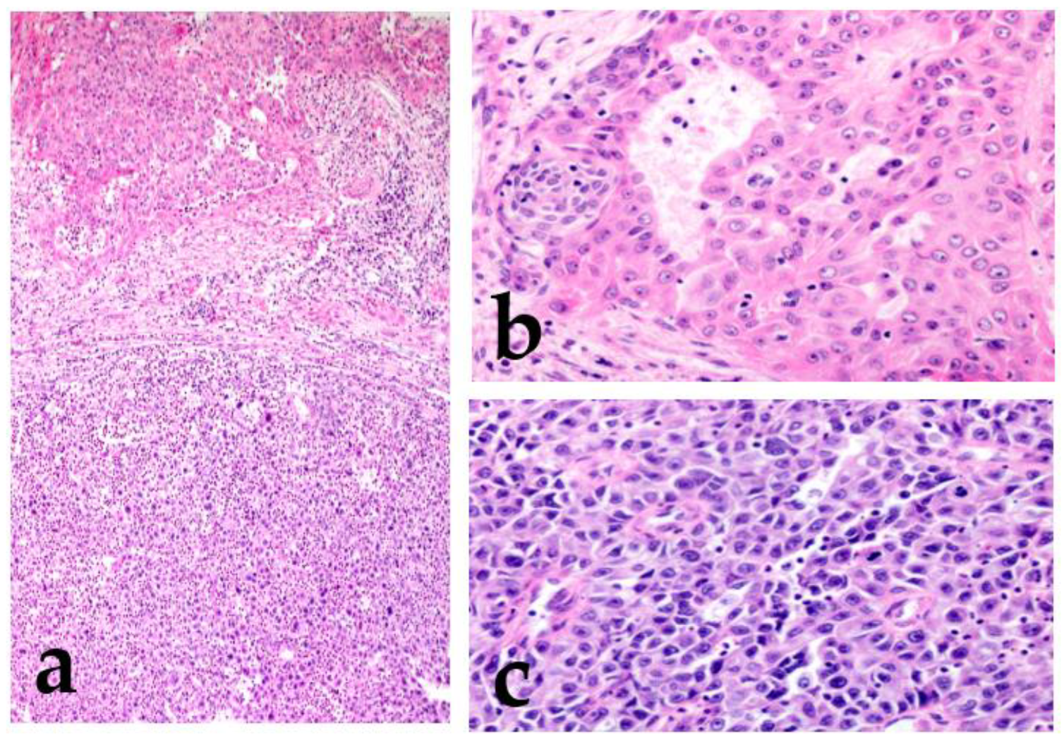 Cancers 15 01236 g001 Cancers 15 01236 g001