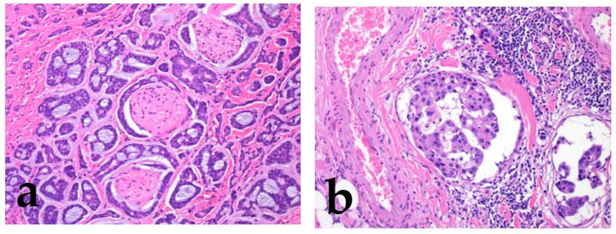 Cancers 15 01236 g003 Cancers 15 01236 g003