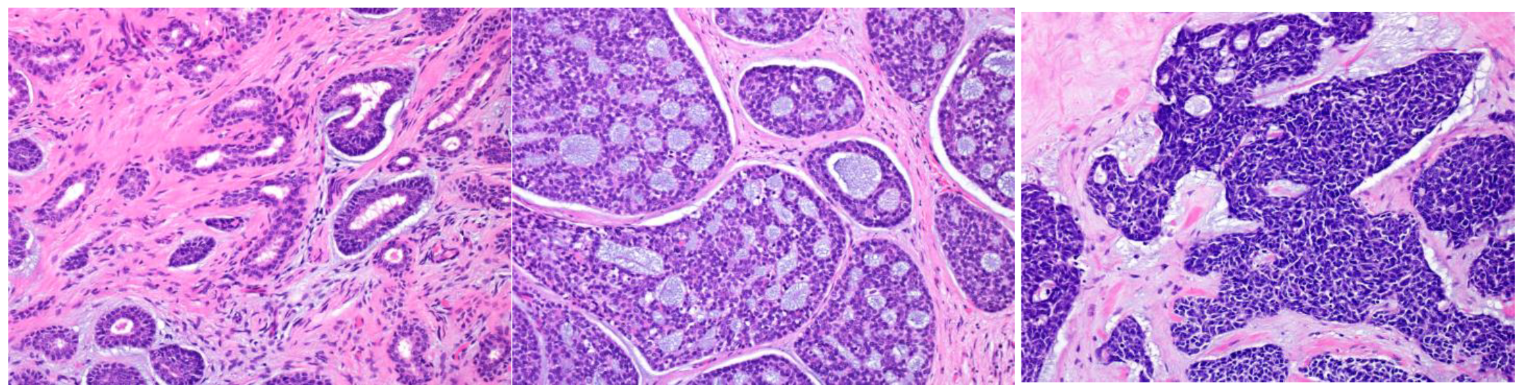 Cancers 15 01236 g005 Cancers 15 01236 g005