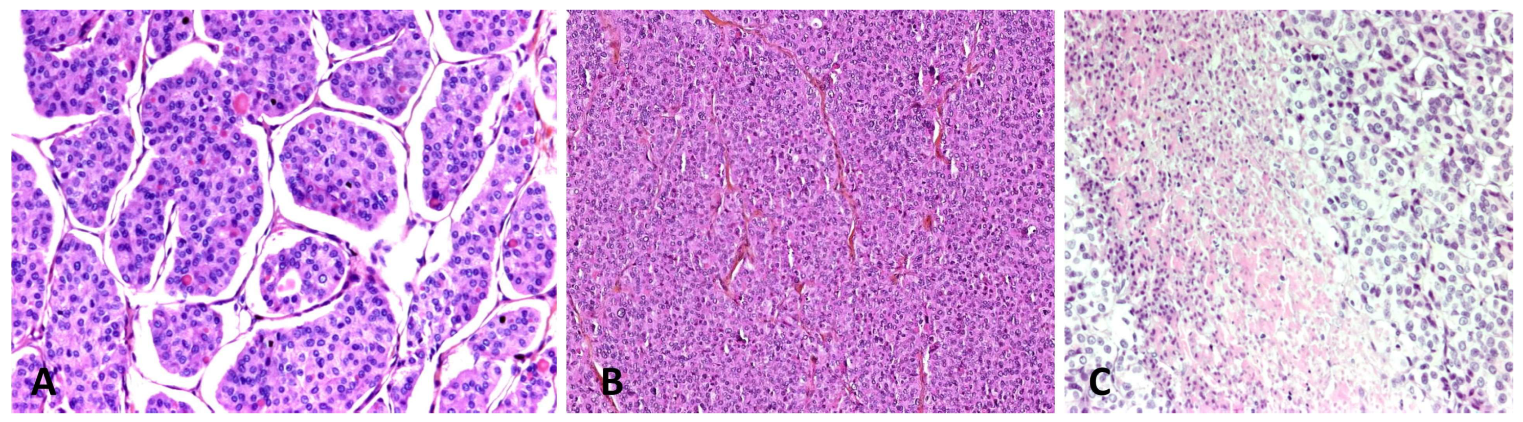 Cancers 15 01255 g001 Cancers 15 01255 g001