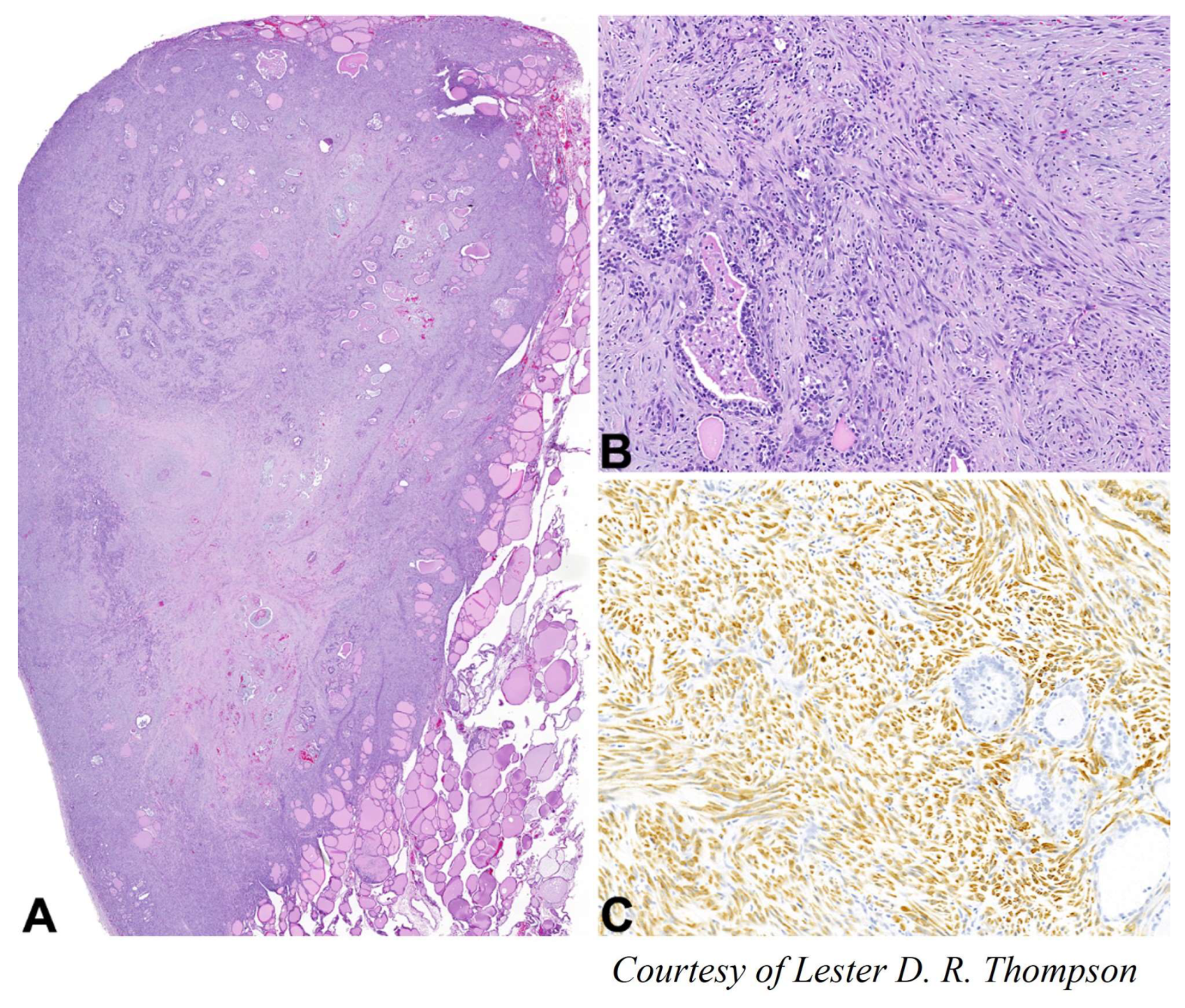 Cancers 15 01255 g007 Cancers 15 01255 g007