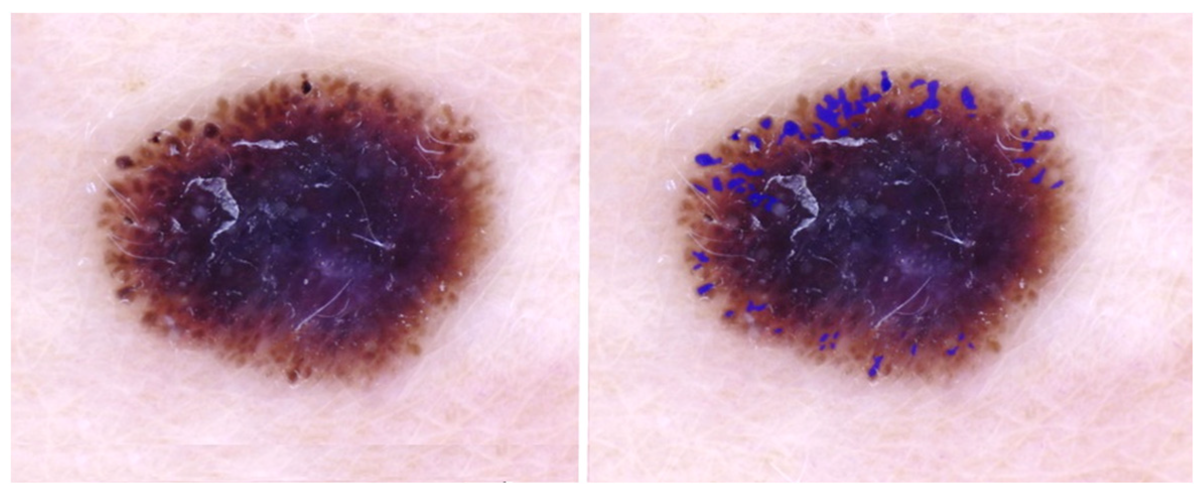 Cancers 15 01259 g003