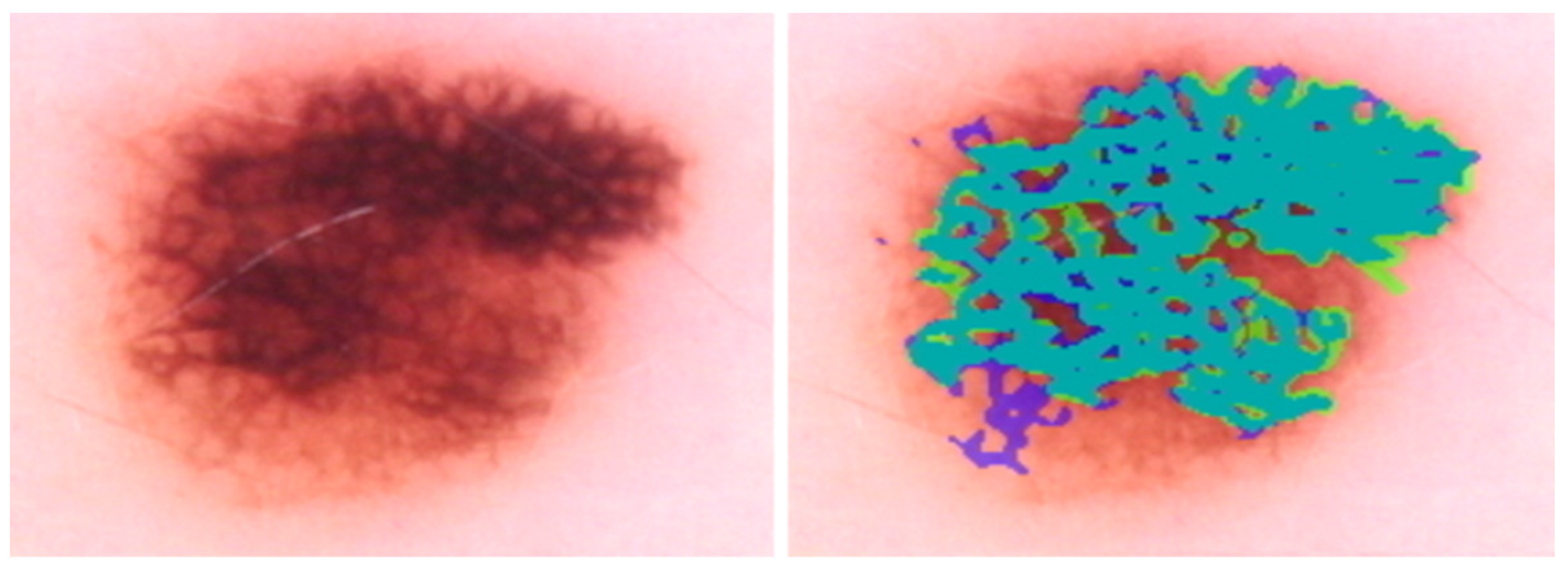 Cancers 15 01259 g005