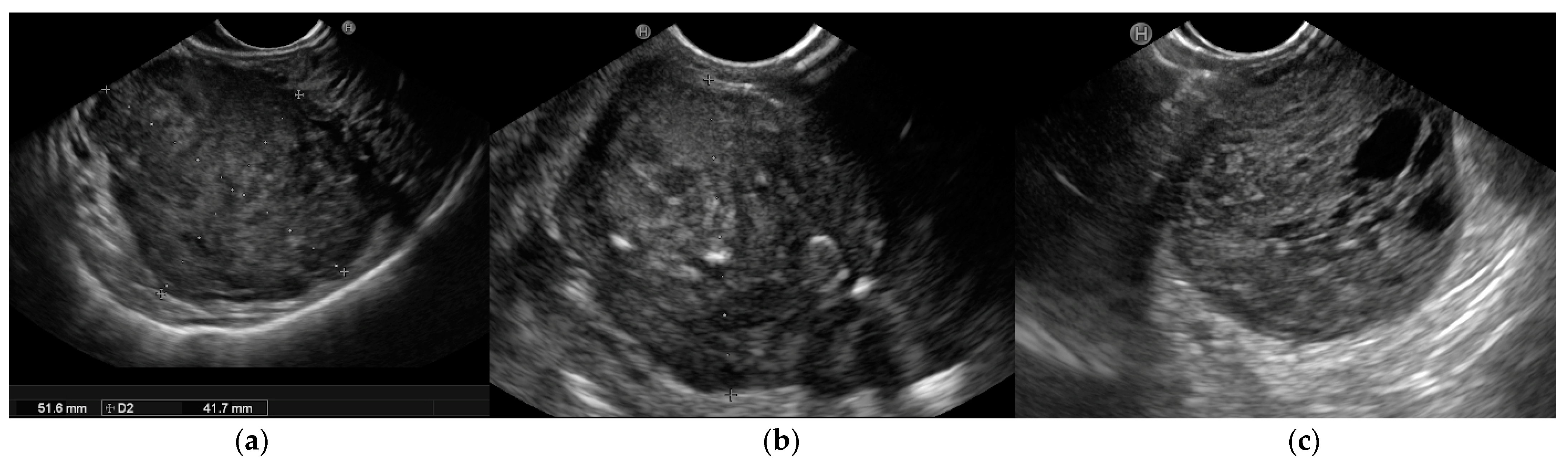 Cancers 15 01285 g001