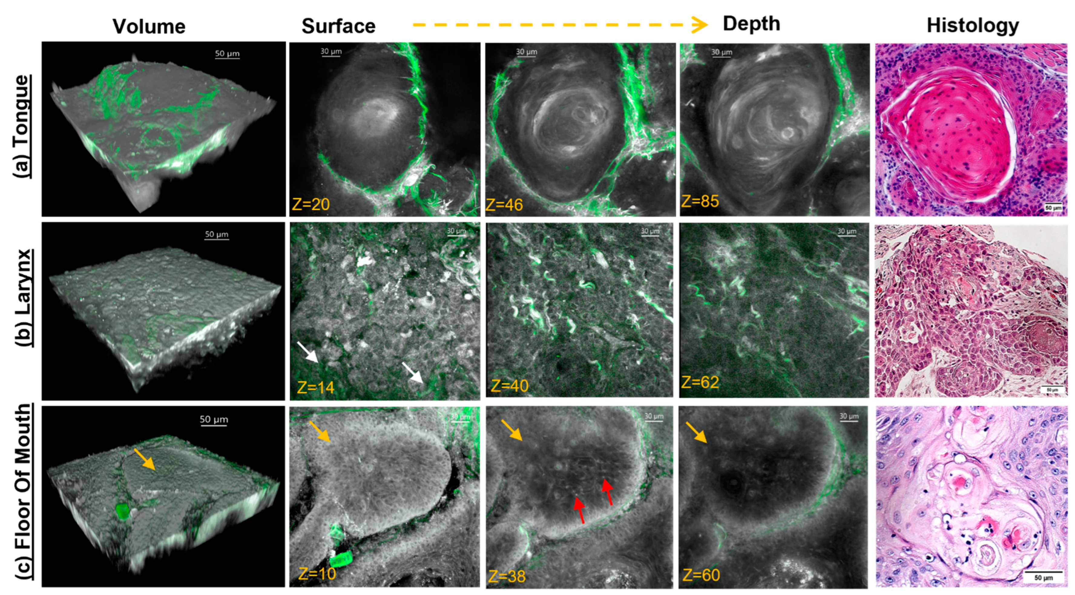 Cancers 15 01302 g002 Cancers 15 01302 g002
