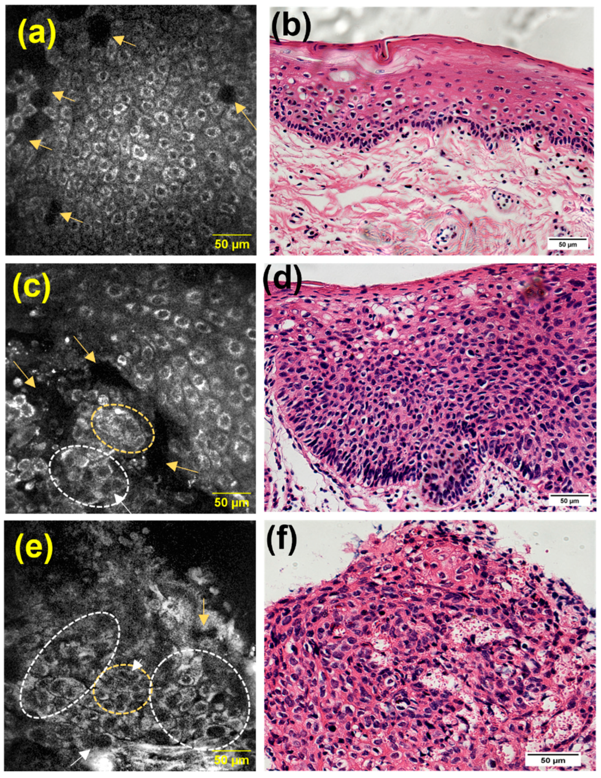 Cancers 15 01302 g005 Cancers 15 01302 g005