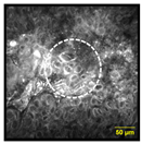 Cancers 15 01302 i005 Cancers 15 01302 i005