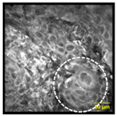 Cancers 15 01302 i007 Cancers 15 01302 i007