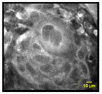 Cancers 15 01302 i008 Cancers 15 01302 i008