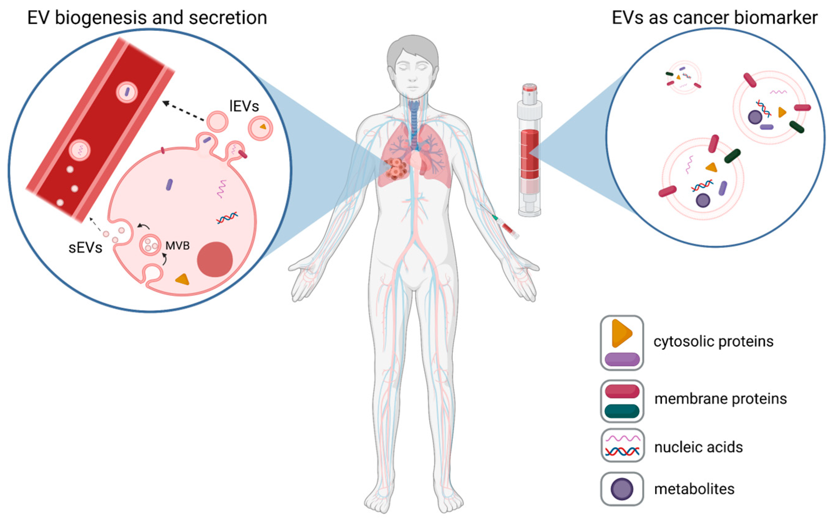 Cancers Free FullText Extracellular Vesicles in Liquid Biopsies as