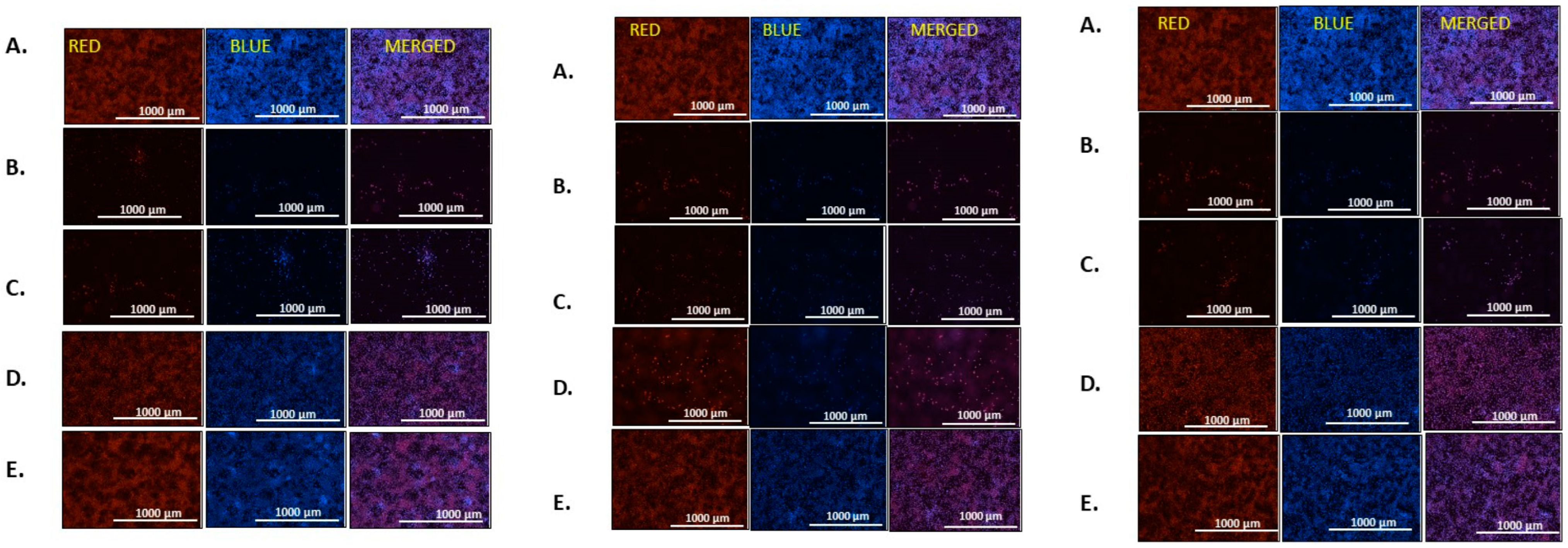Cancers 15 01318 g004 Cancers 15 01318 g004