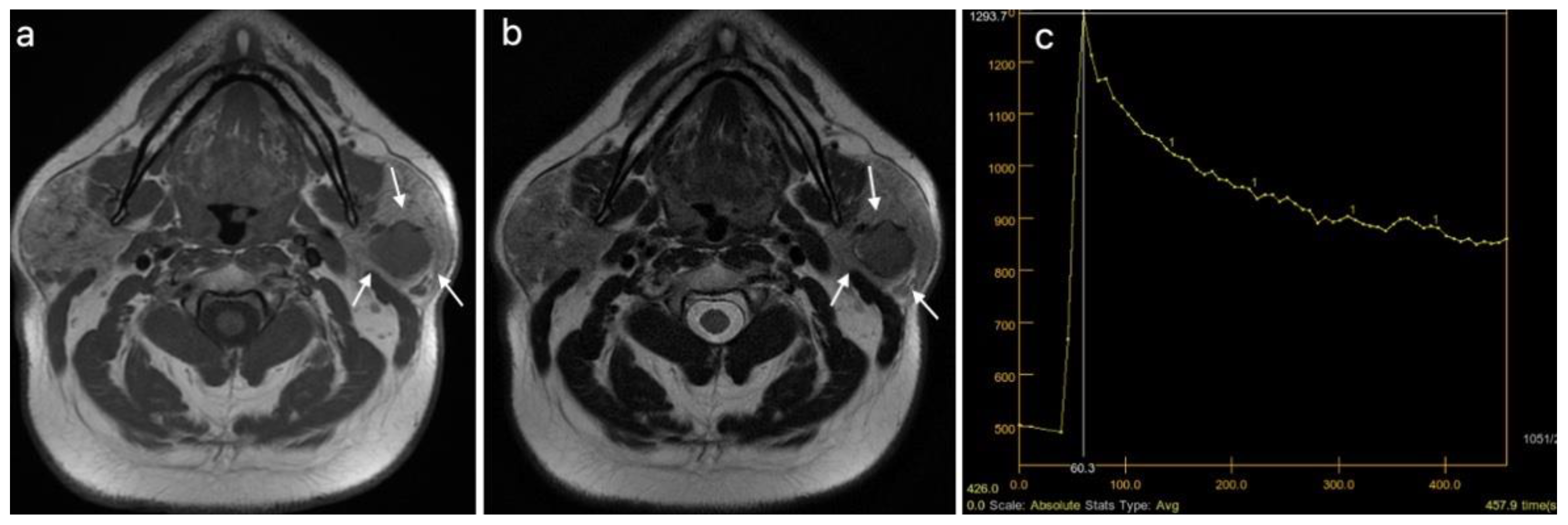 Cancers 15 01325 g004 Cancers 15 01325 g004