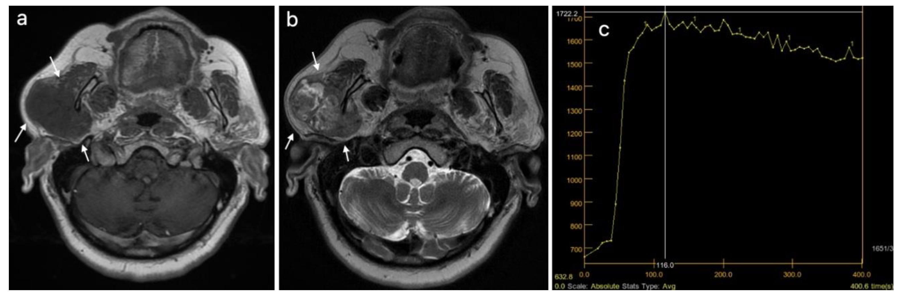 Cancers 15 01325 g005 Cancers 15 01325 g005