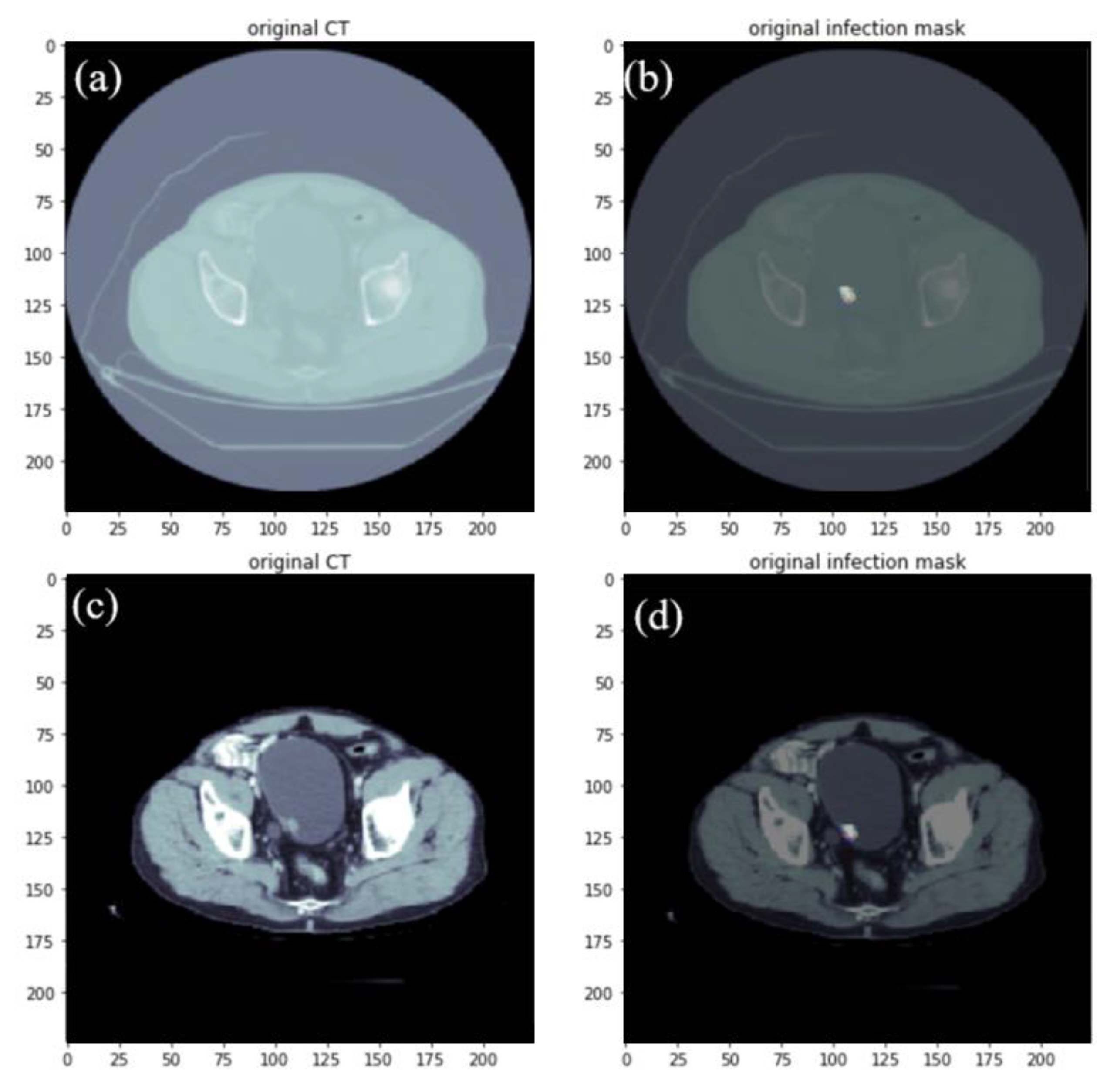 Cancers 15 01343 g002 Cancers 15 01343 g002