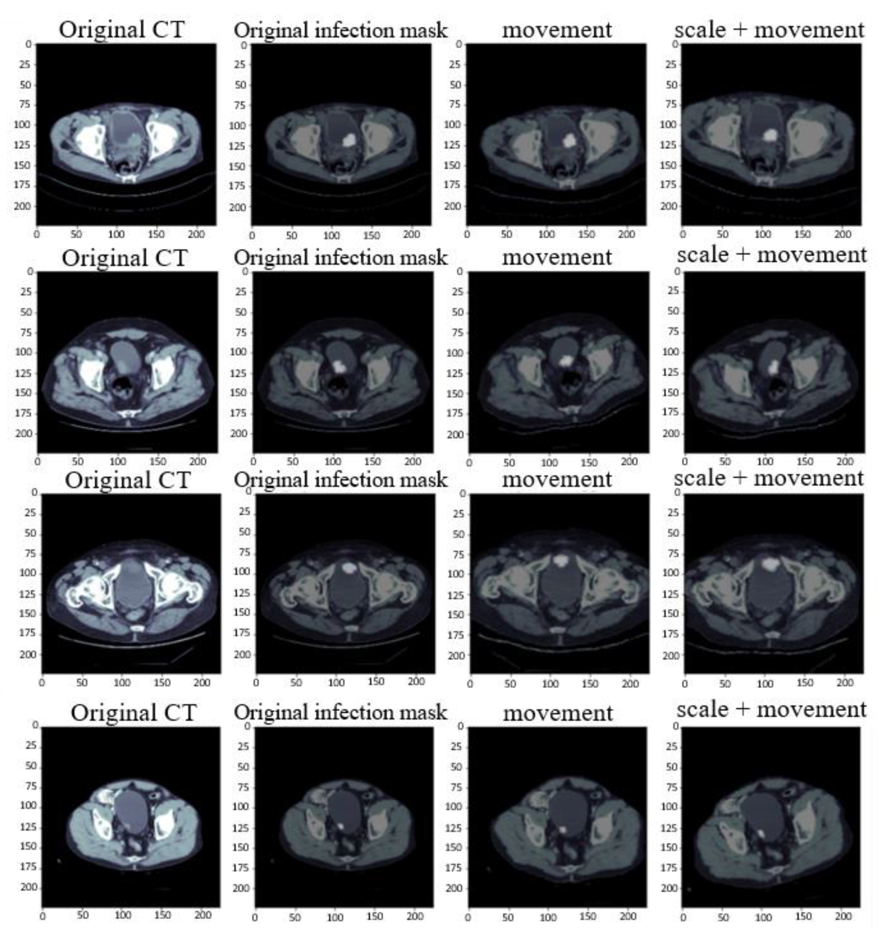 Cancers 15 01343 g003 Cancers 15 01343 g003