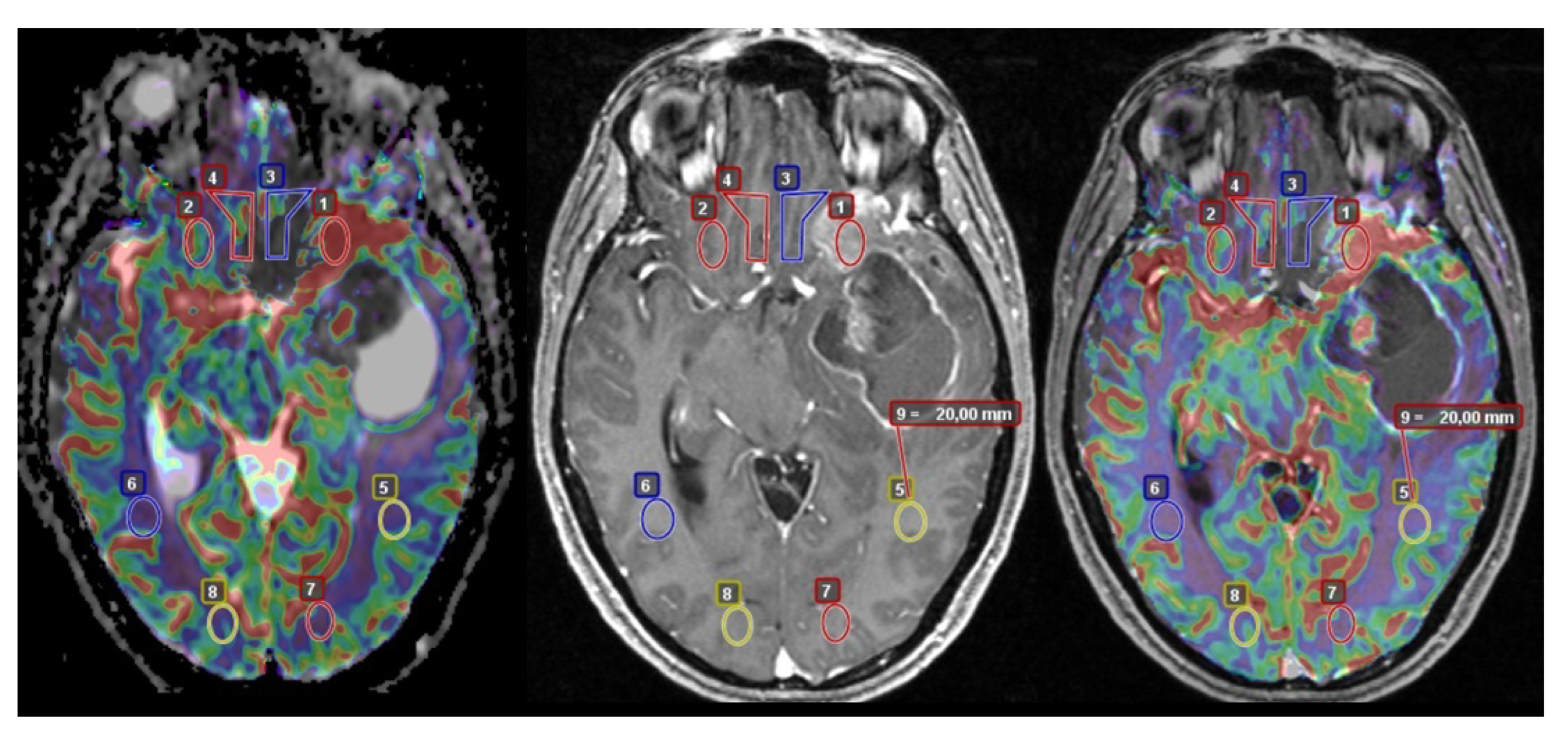 Cancers 15 01384 g001 Cancers 15 01384 g001