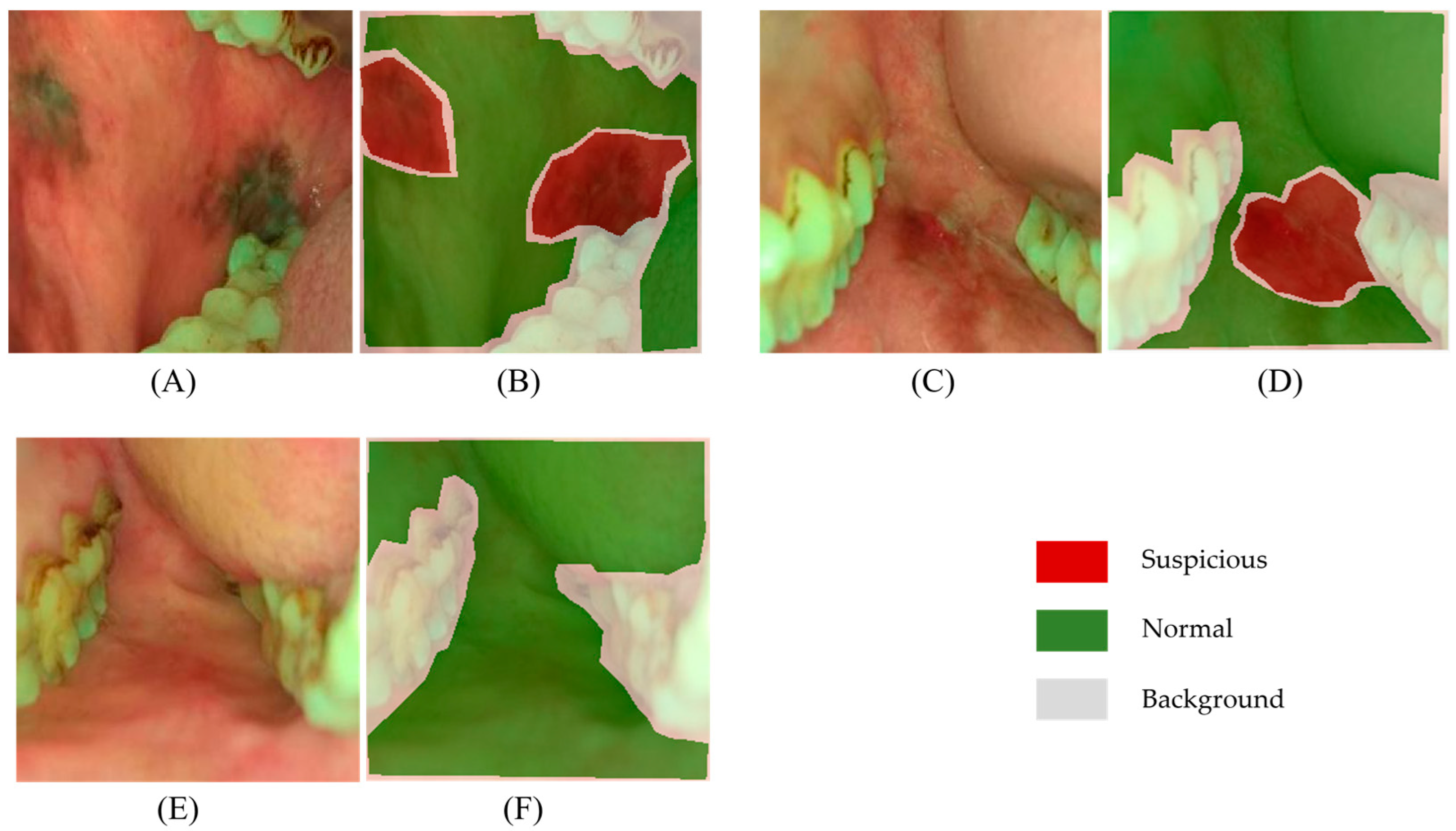 Cancers 15 01421 g003 Cancers 15 01421 g003